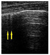Diagnostics 14 00440 i001
