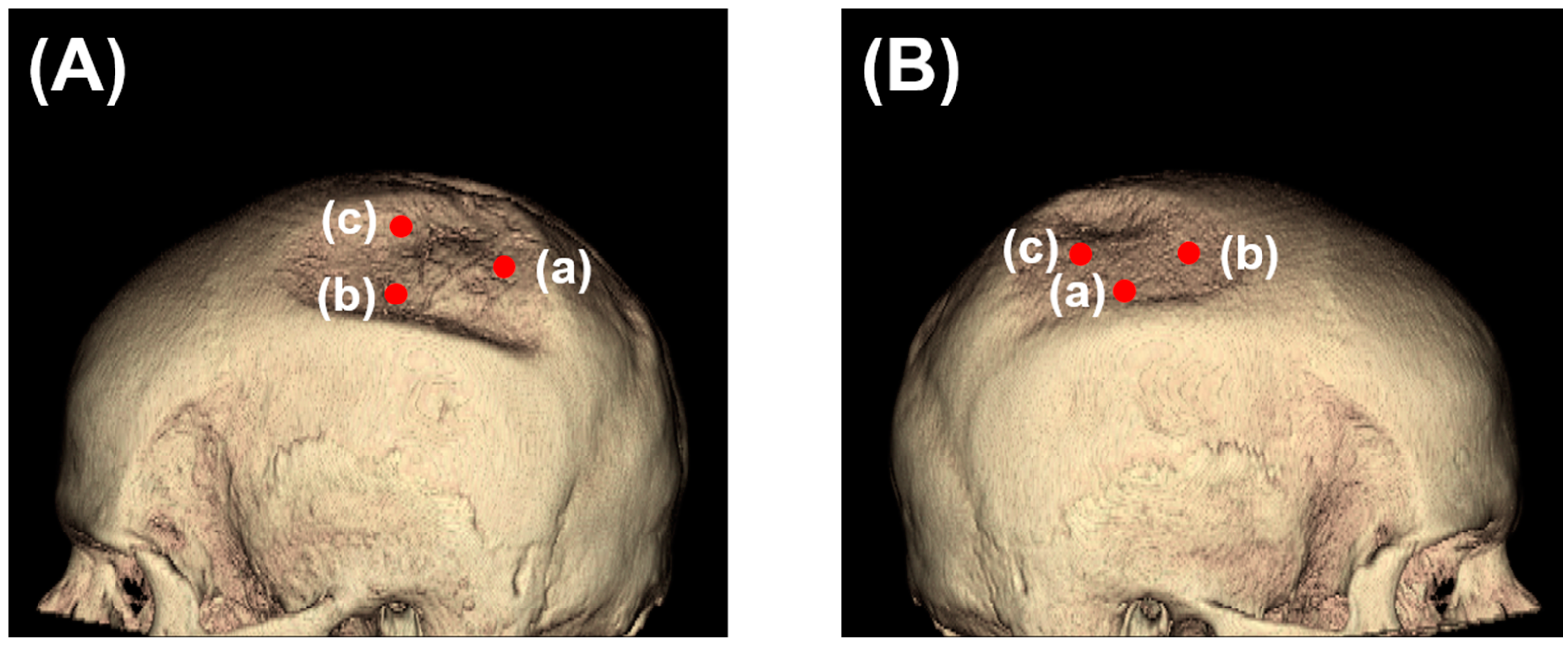 Diagnostics 14 00446 g001