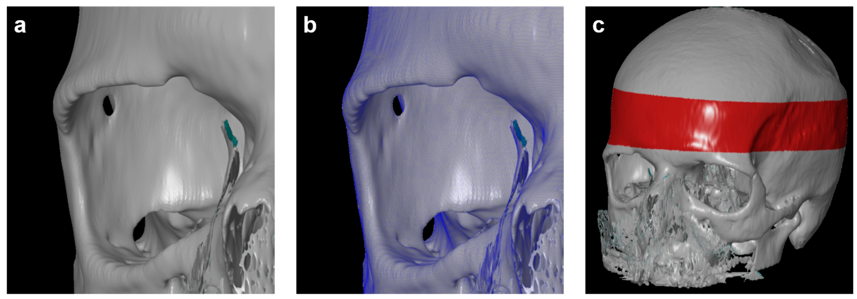 Diagnostics 14 00446 g003