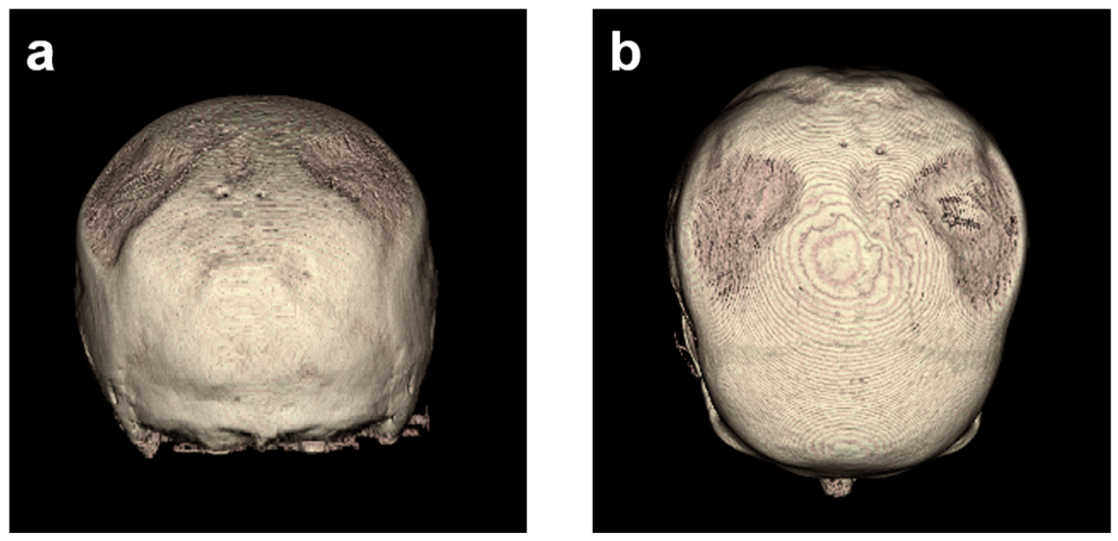 Diagnostics 14 00446 g004