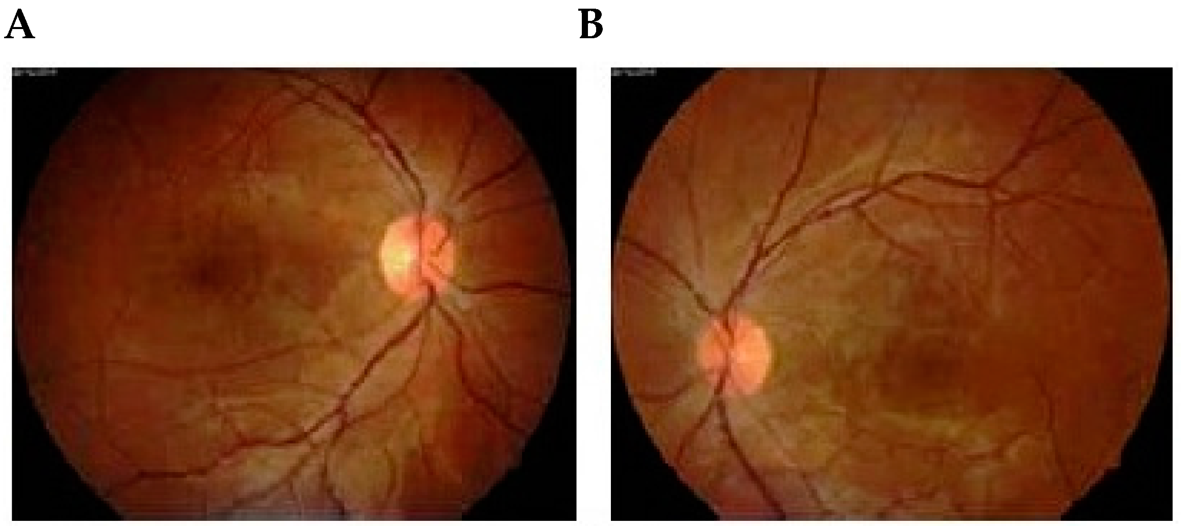 Diseases 04 00019 g002a