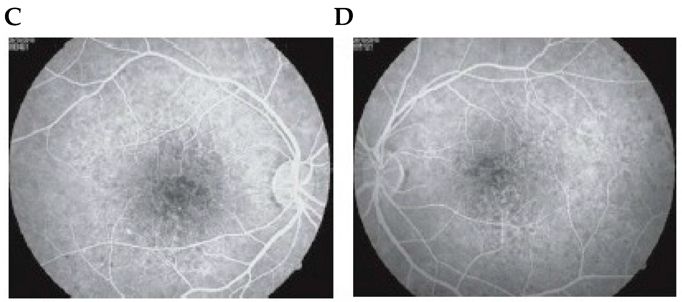 Diseases 04 00019 g002b