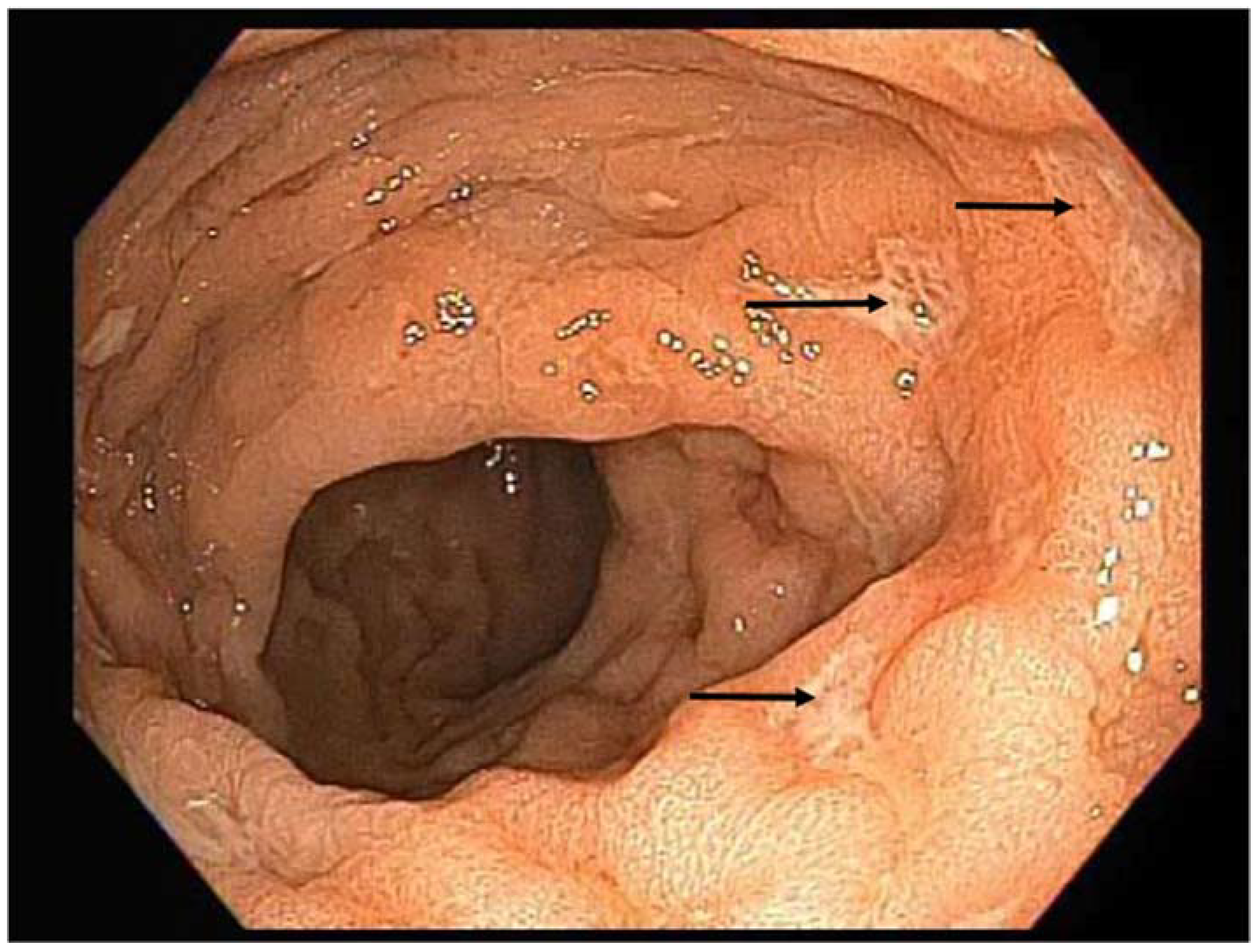Diseases 06 00036 g001