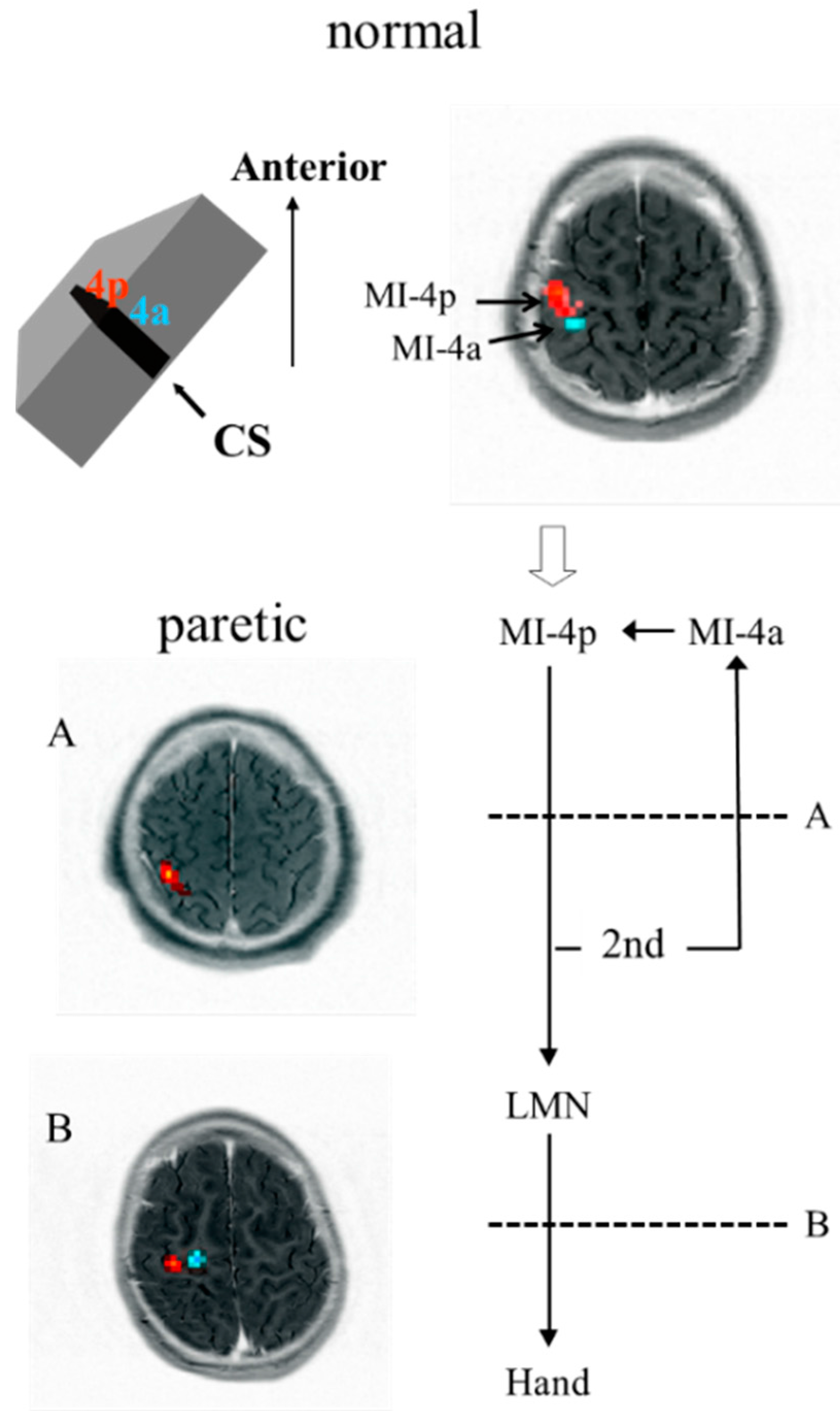 entropy free full text single to two cluster state transition of which letter indicates the primary somatosensory cortex