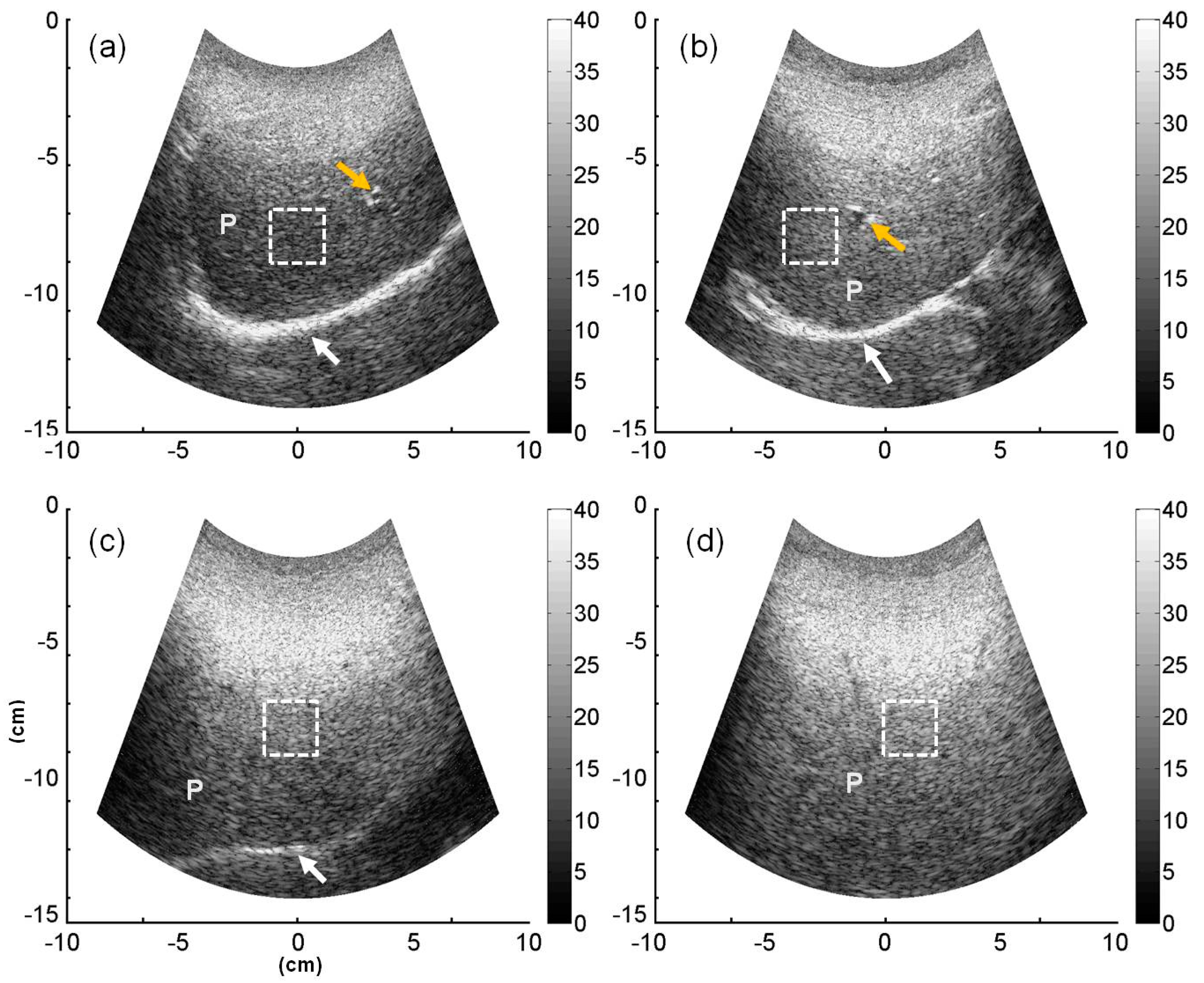 Entropy 18 00341 g002