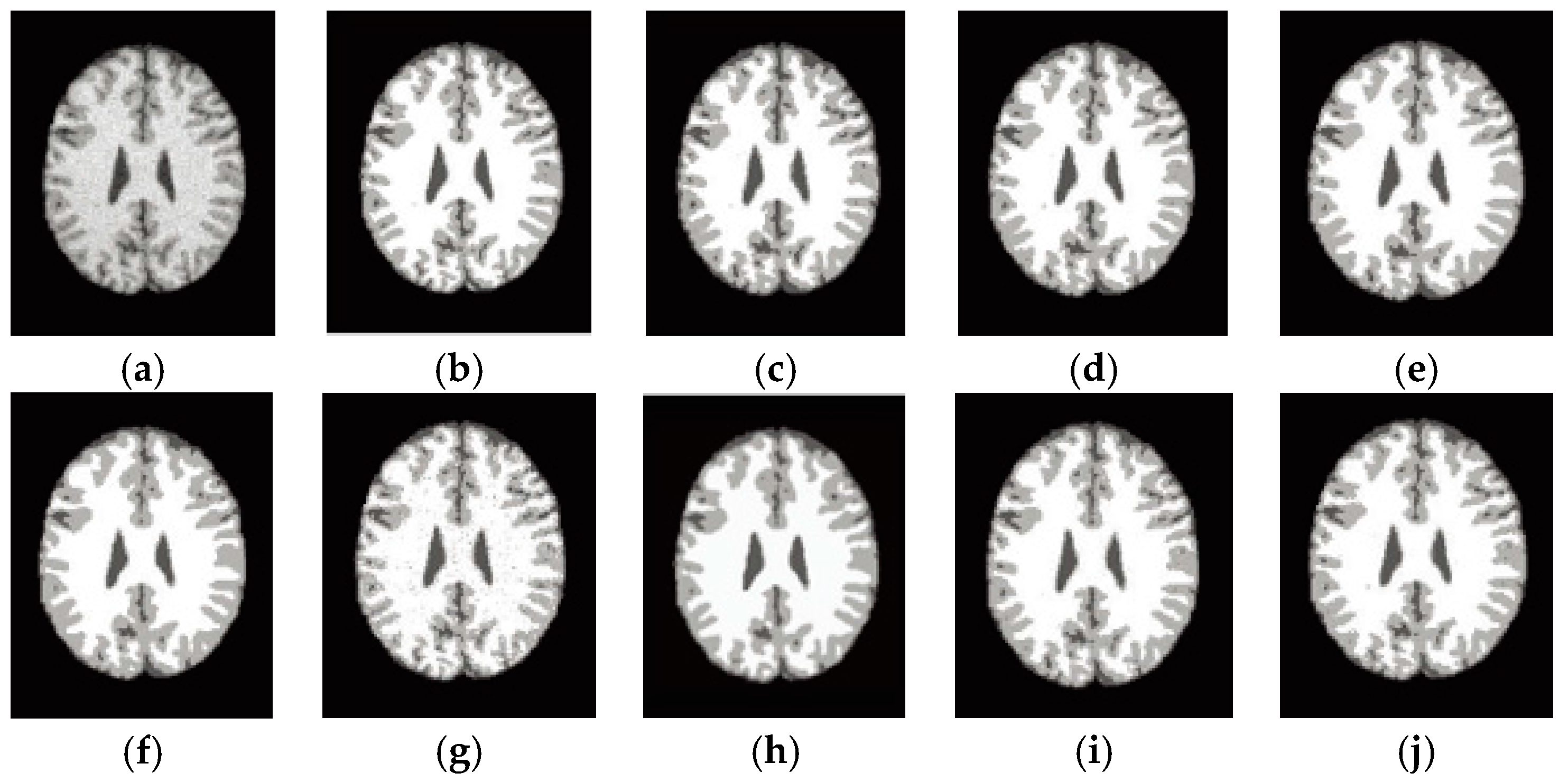 Entropy 19 00578 g005