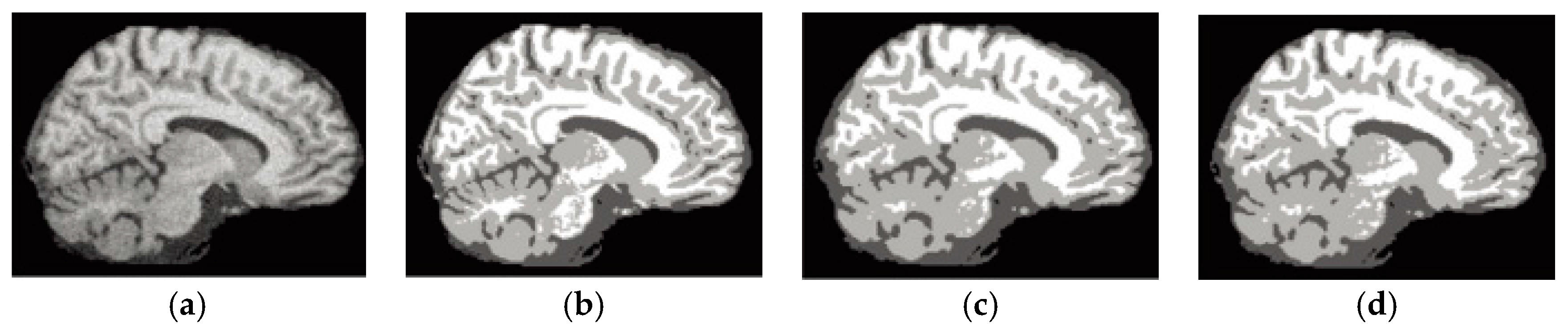 Entropy 19 00578 g006a