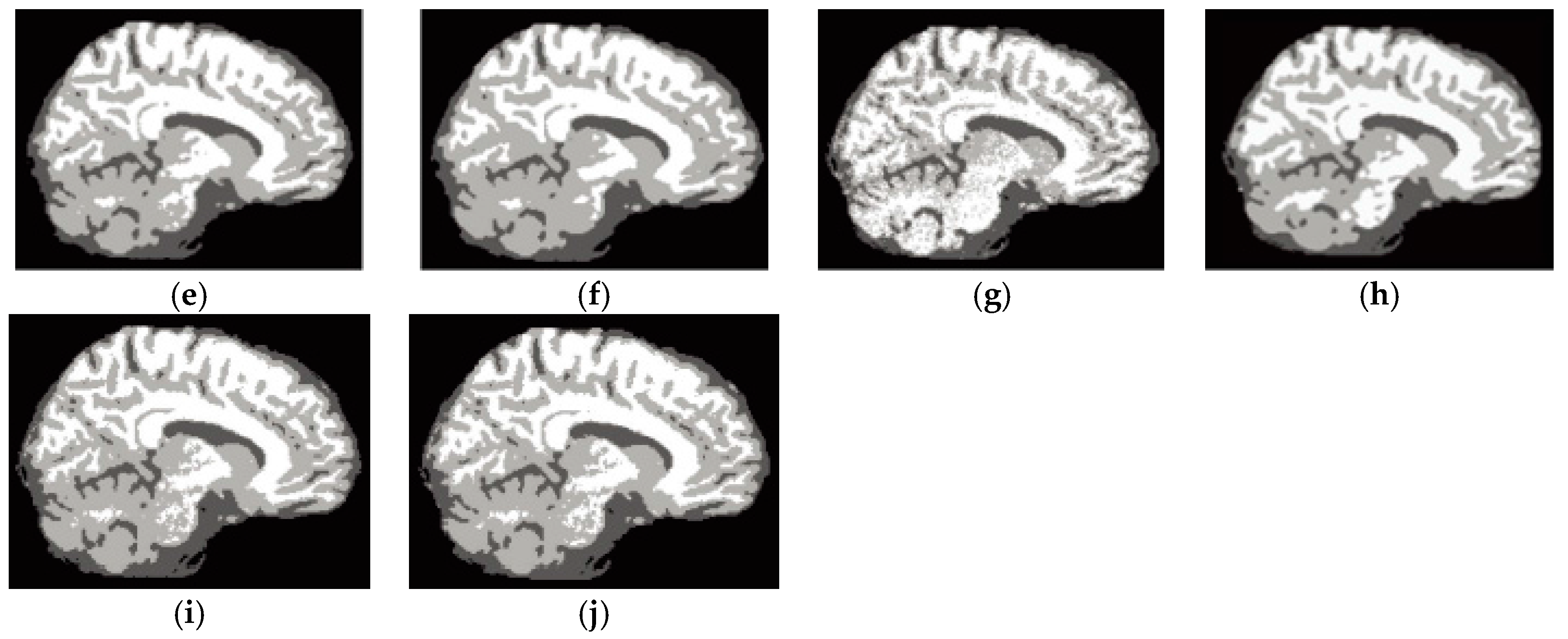 Entropy 19 00578 g006b