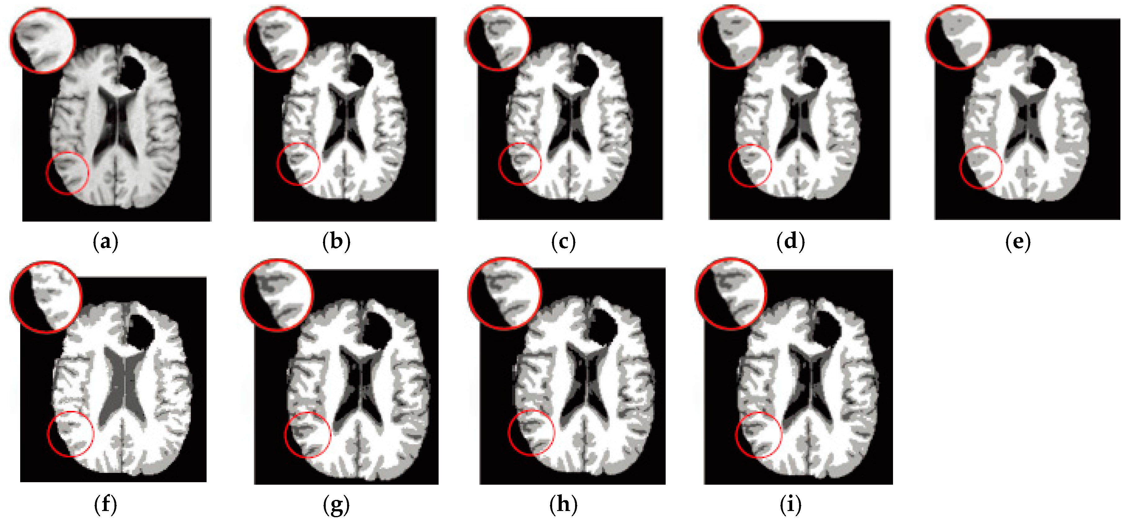 Entropy 19 00578 g008