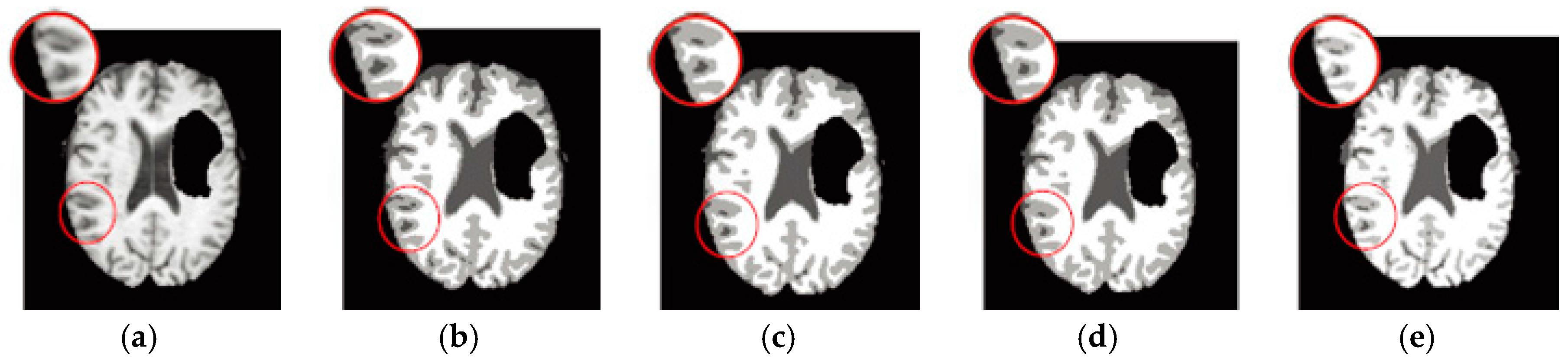 Entropy 19 00578 g009a