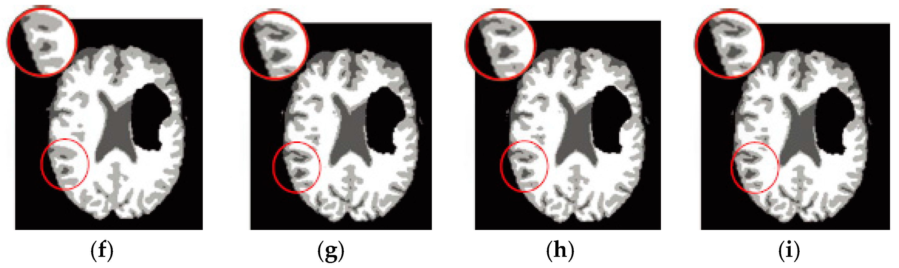 Entropy 19 00578 g009b