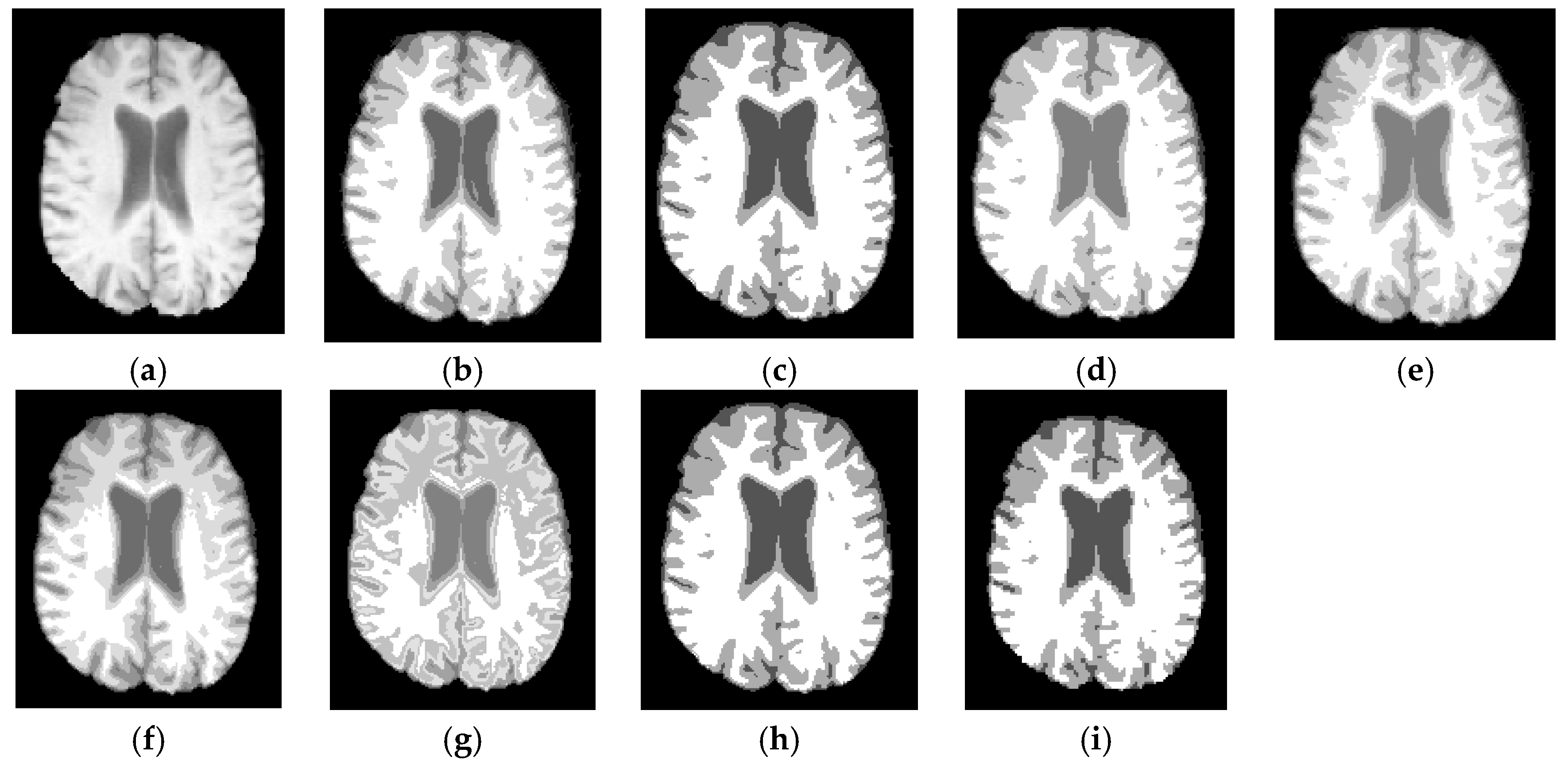Entropy 19 00578 g010