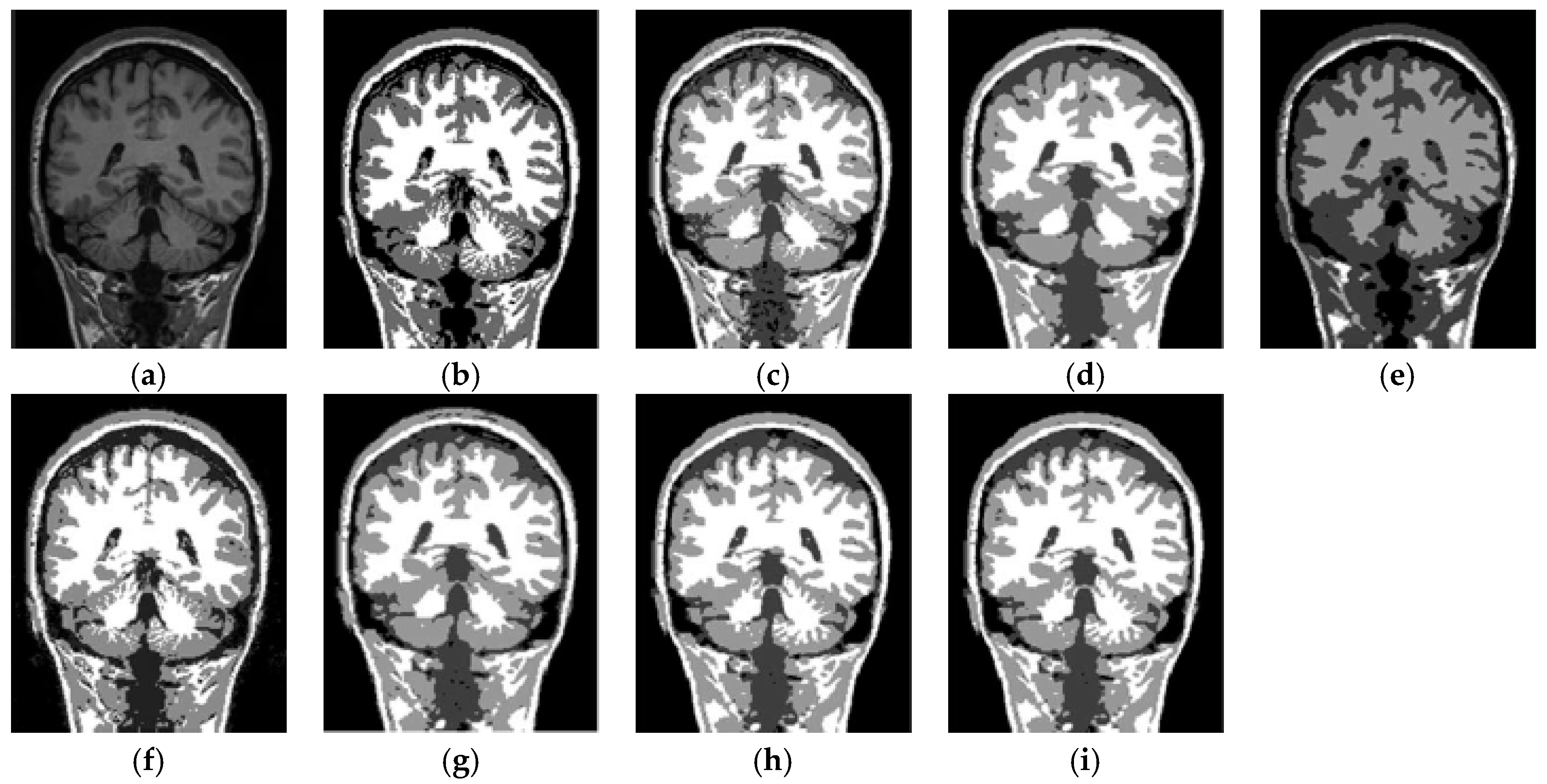 Entropy 19 00578 g011