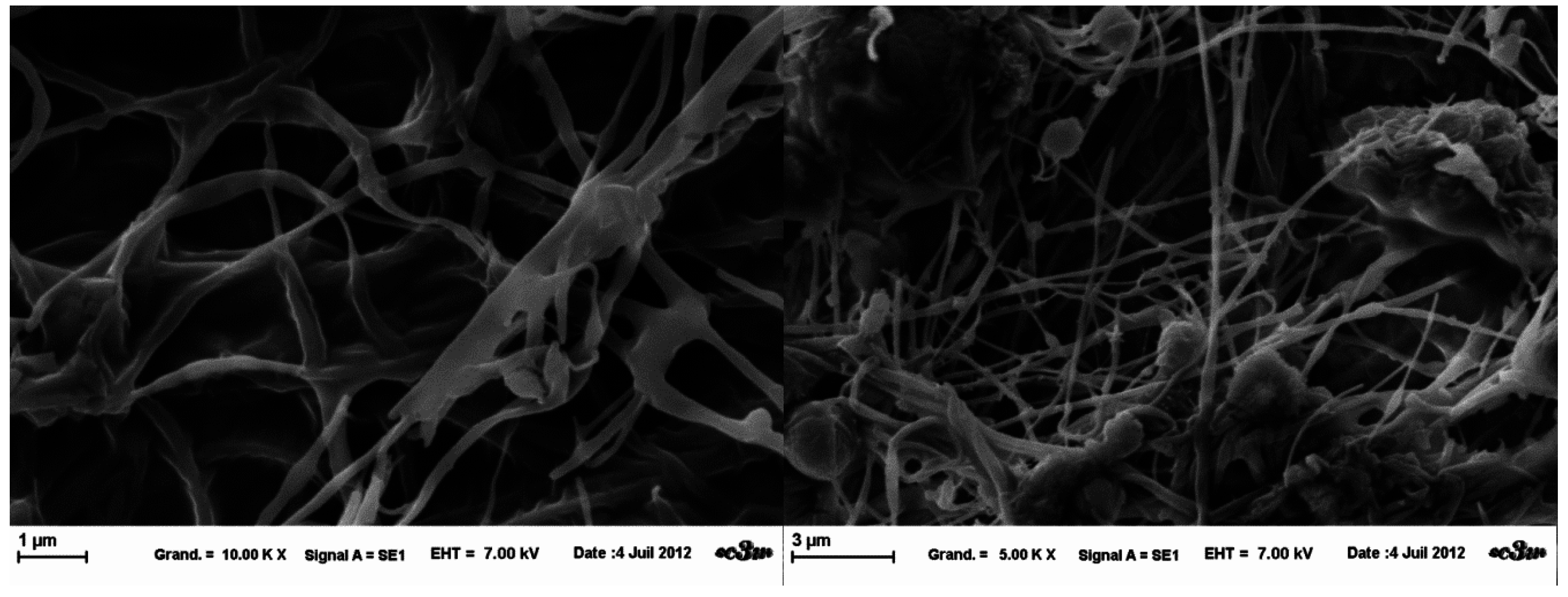 hpmc case study Trast to »amorphous suspensions« in other three cases the in vitro the aim of the present study was to examine the solubility and dissolution proper- initially, 20% (m/m) of the excipient (tartaric acid, mannitol, pvp and hpmc) was used. hpmc case study Trast to »amorphous suspensions« in other three cases the in vitro the aim of the present study was to examine the solubility and dissolution proper- initially, 20% (m/m) of the excipient (tartaric acid, mannitol, pvp and hpmc) was used.