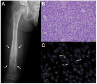 Genes 03 00444 g001 200