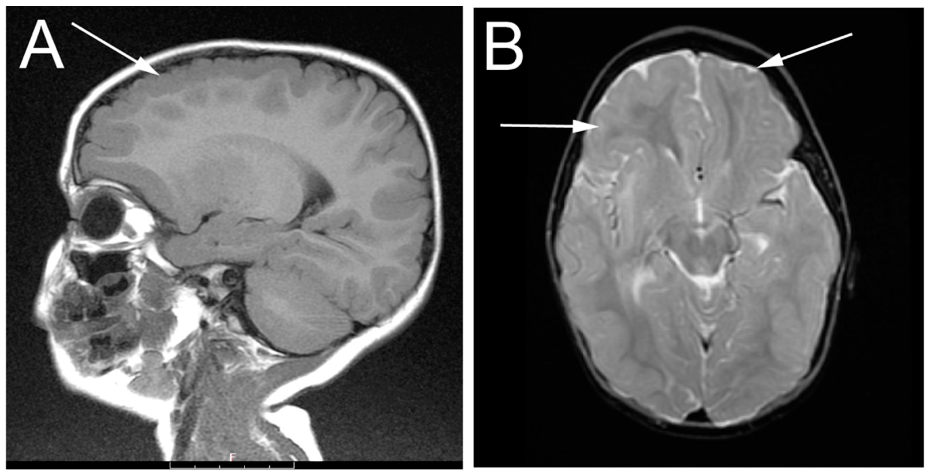 Genes 07 00085 g001