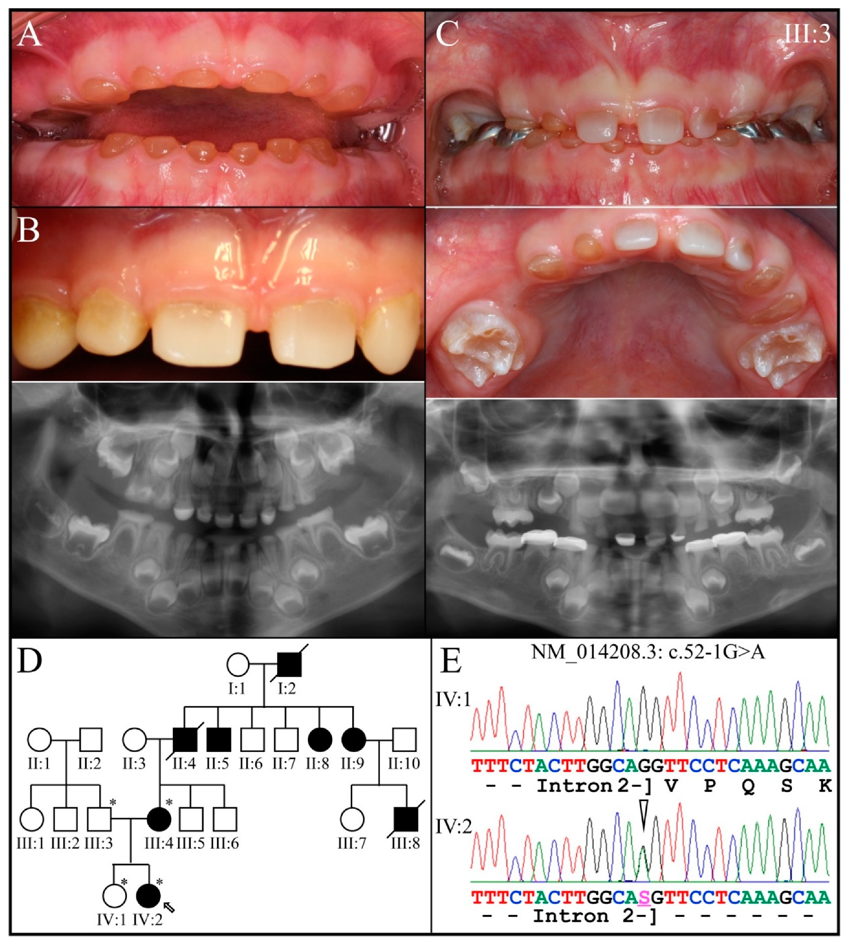 Genes 13 00858 g003