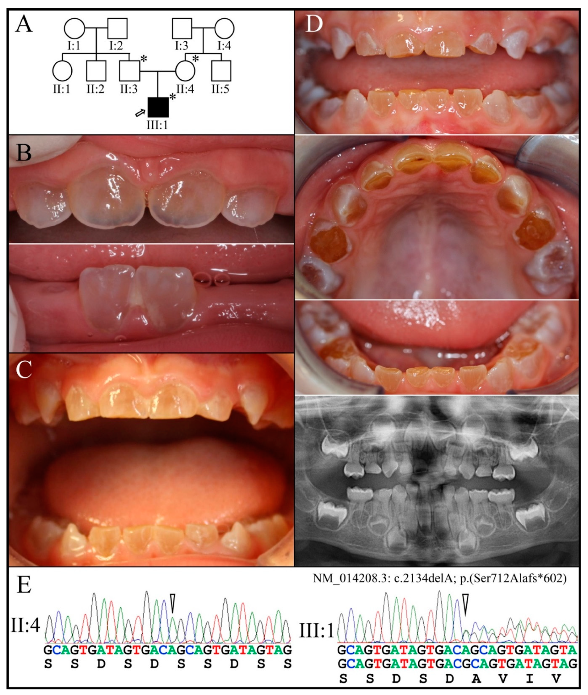 Genes 13 00858 g010