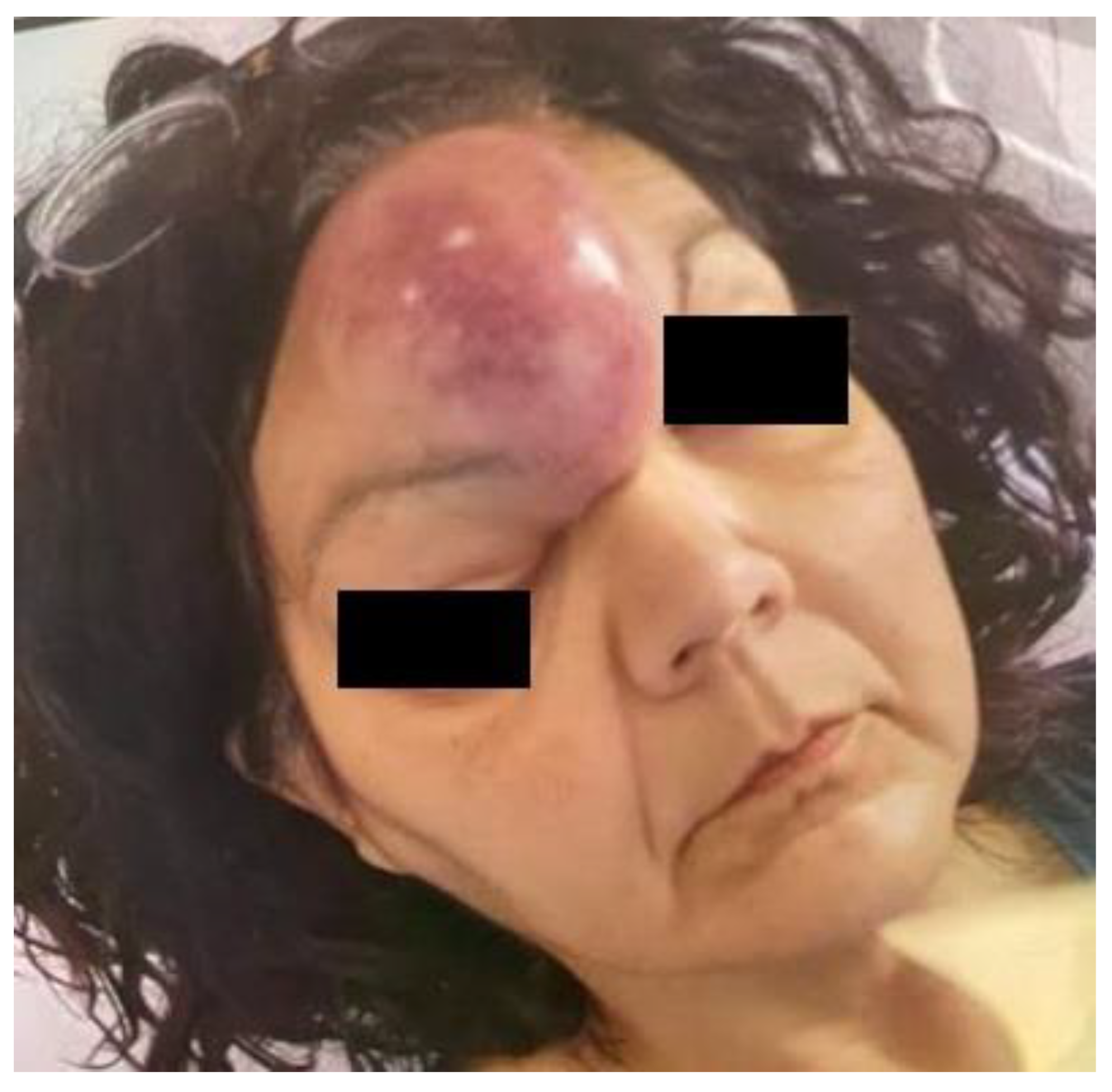 Hematolrep 15 00055 g001