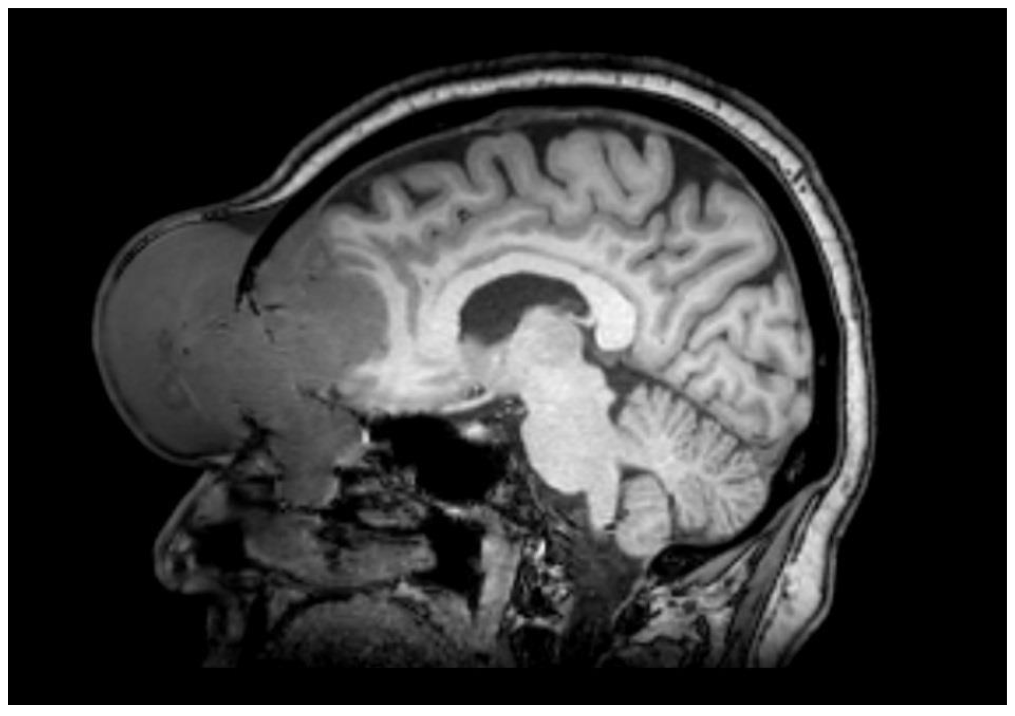 Hematolrep 15 00055 g002