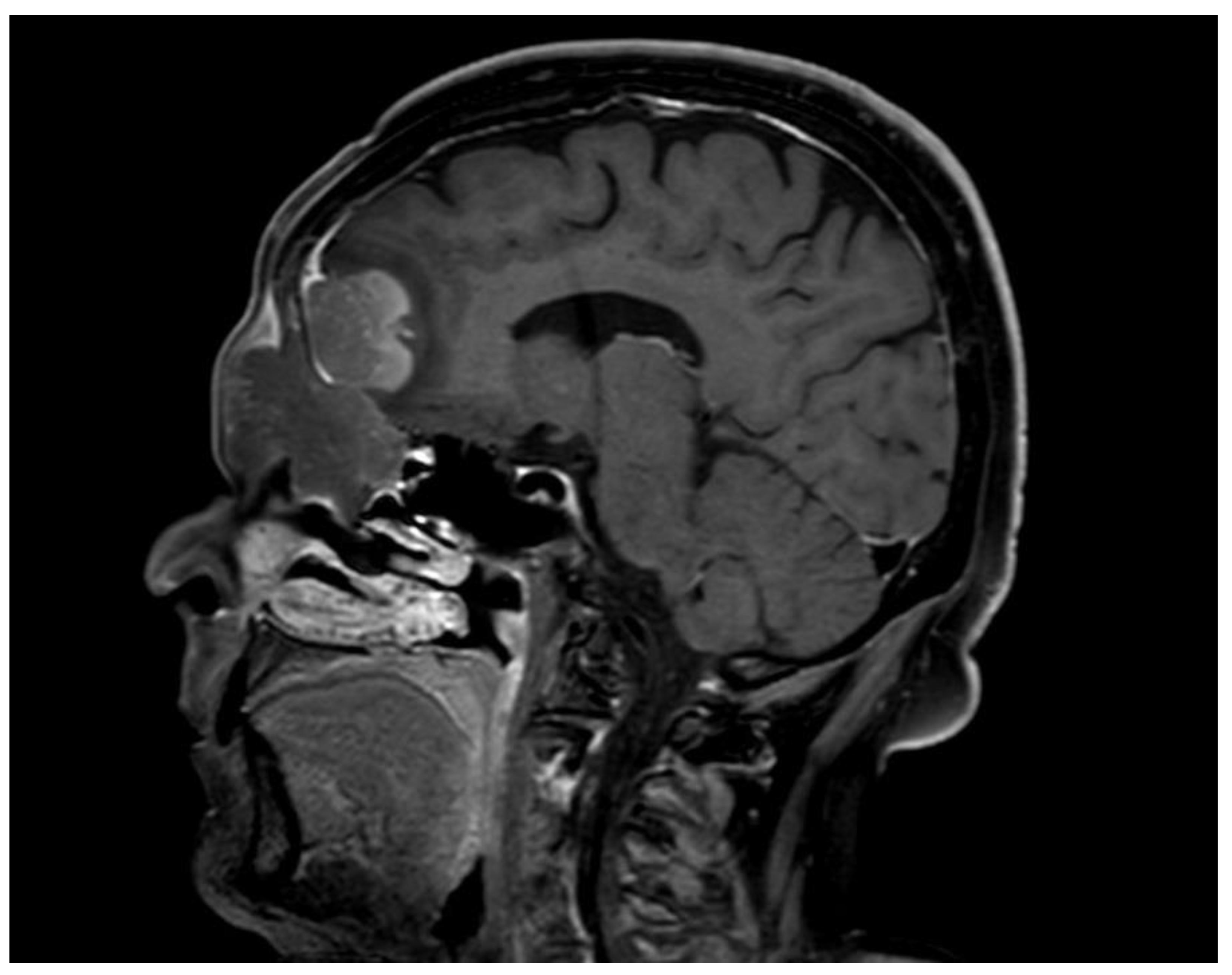 Hematolrep 15 00055 g003