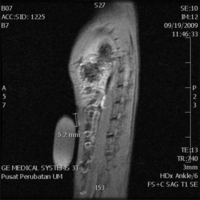 Ijms 12 01030f2 200