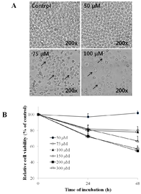 Ijms 13 11912f1 200