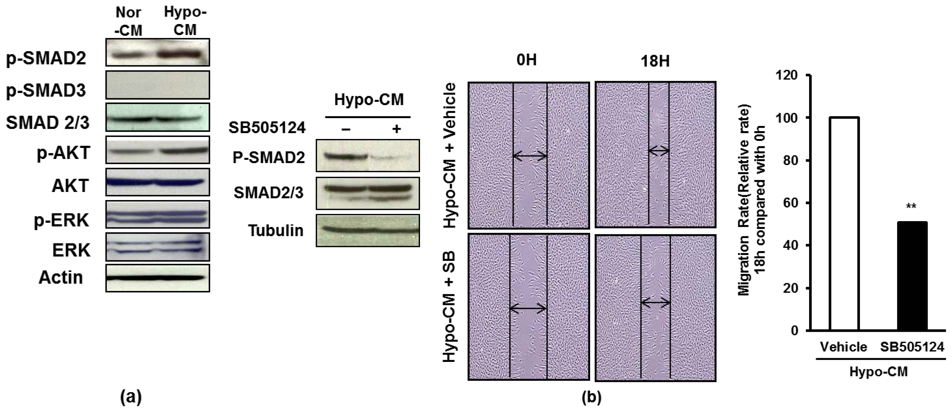 pcsk9 hepatocyte specific role dissected essay pcsk9 hepatocyte specific role dissected essay
