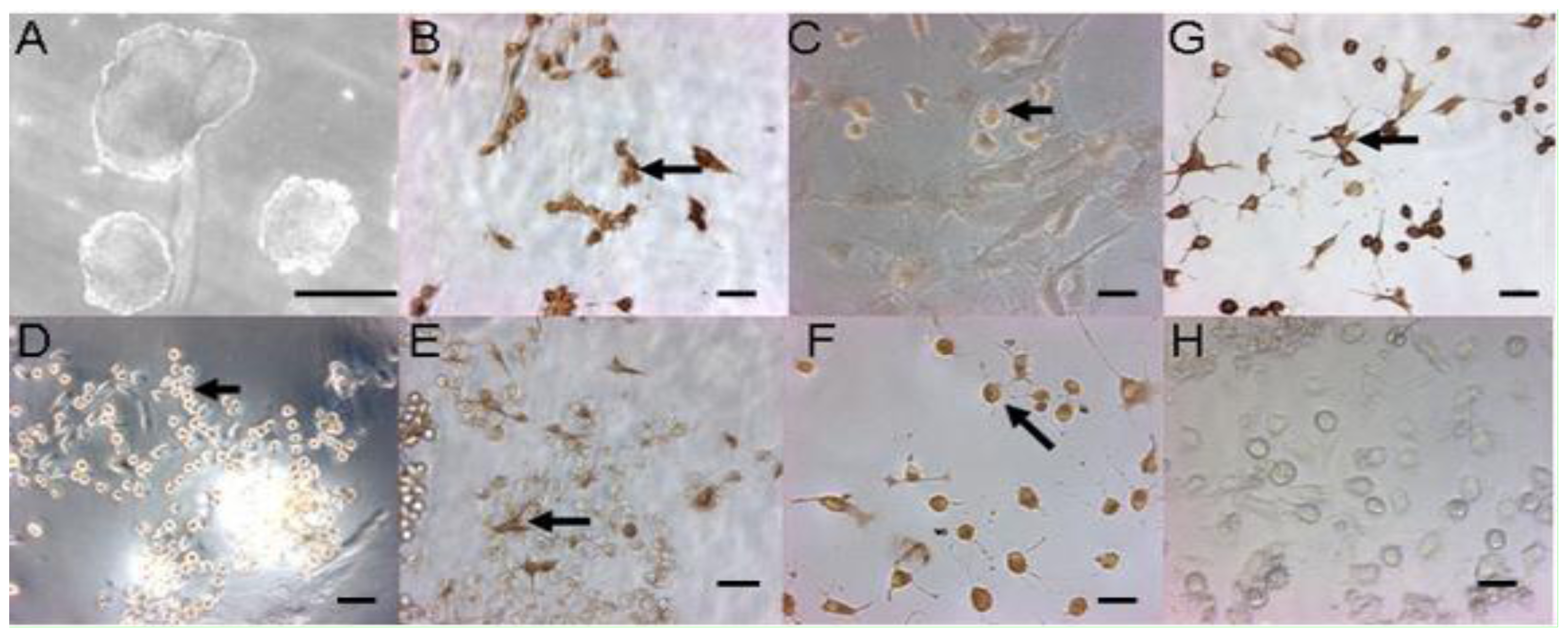 chinese mice analysis Metabolomic analysis of complex chinese remedies: examples of induced nephrotoxicity in the mouse from a series of remedies. chinese mice analysis Metabolomic analysis of complex chinese remedies: examples of induced nephrotoxicity in the mouse from a series of remedies.