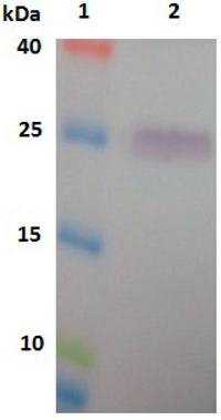 Ijms 15 10215 g005 200