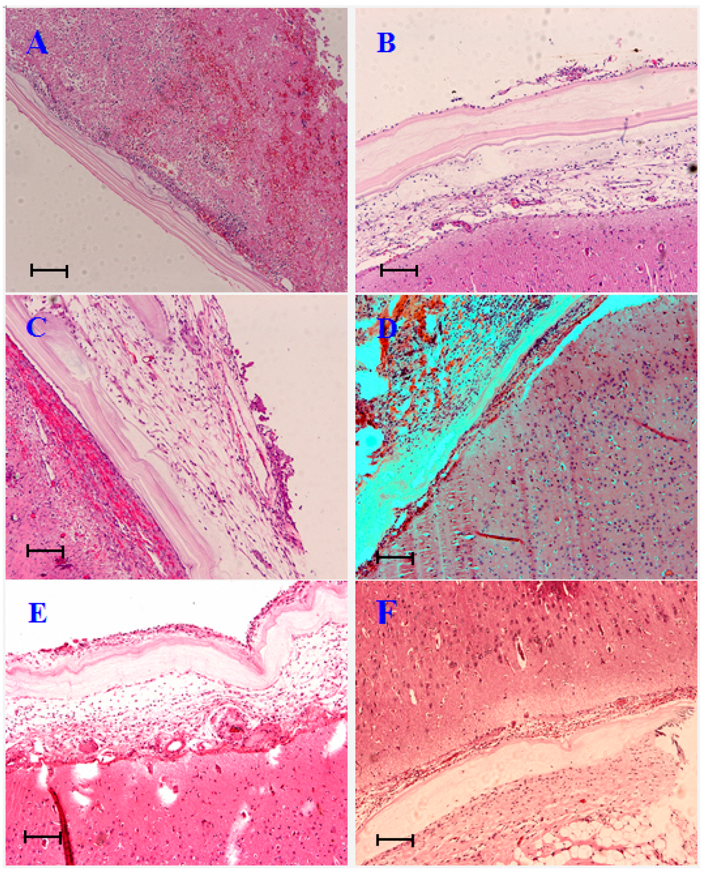 Ijms 15 10855 g002 1024