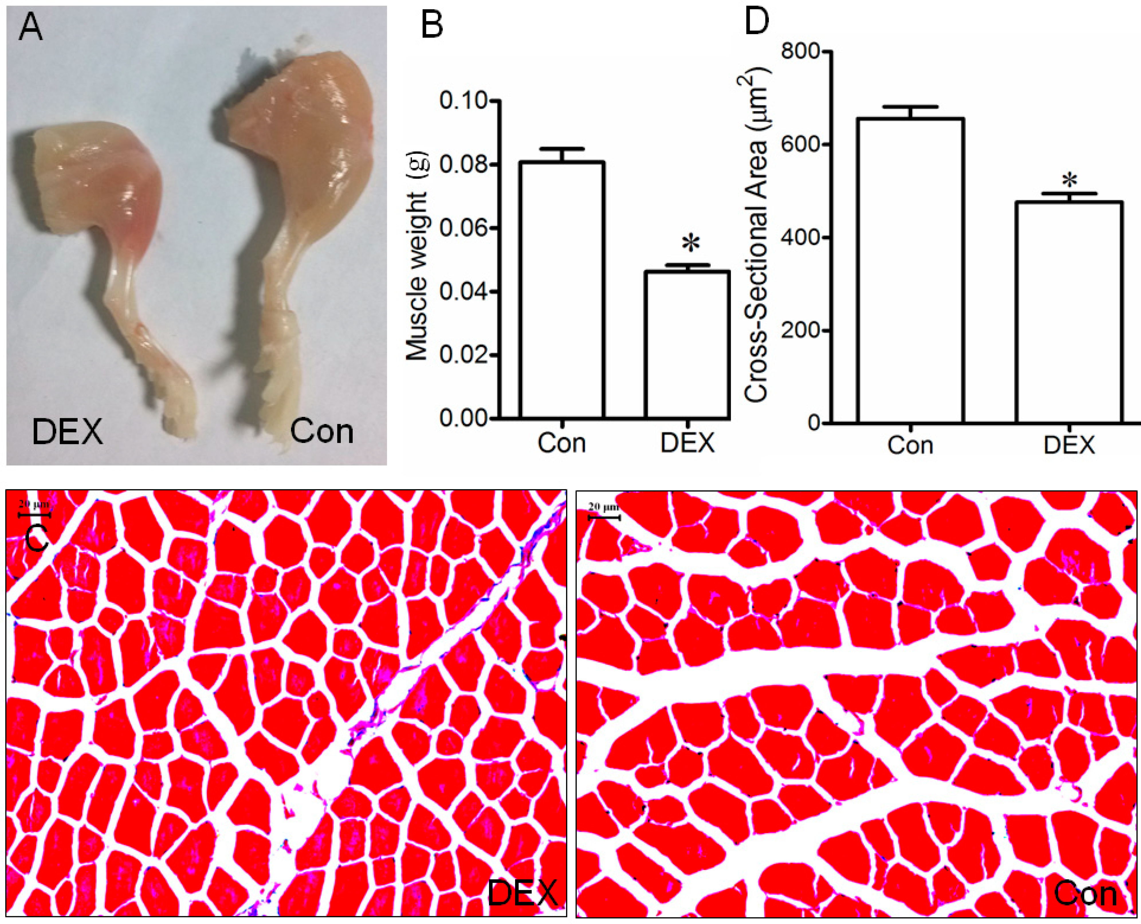 IJMS | Free Full-Text | TRAF6 Inhibition Rescues Dexamethasone-Induced