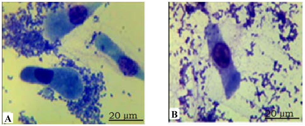 Ijms 15 11161 g001 1024