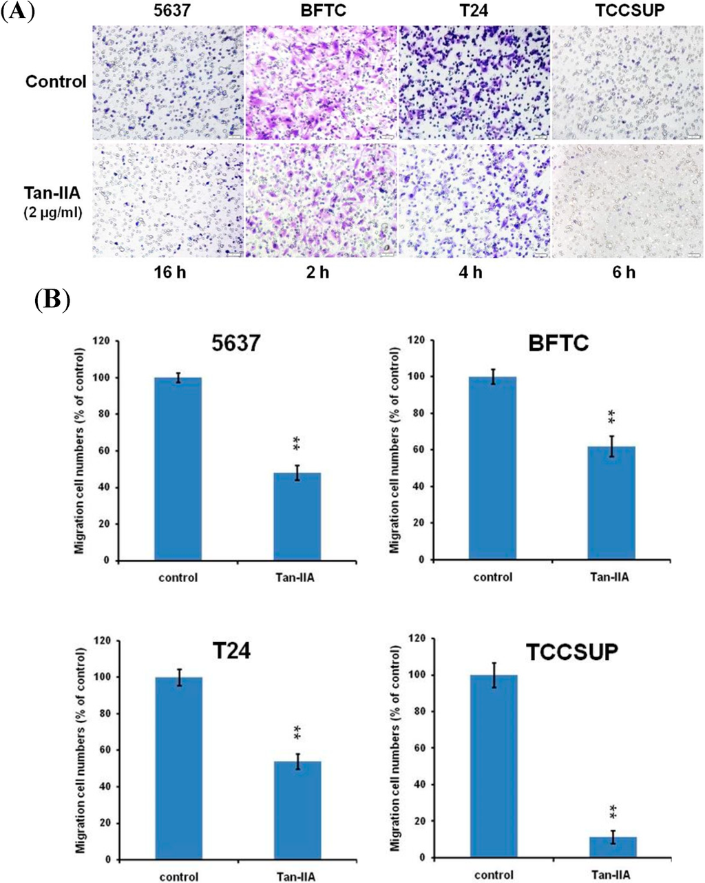 migration potential of cancel cells Curcumin blocks small cell lung cancer cells migration, invasion, angiogenesis, cell potential in sclc cancerwe cancer cell transwell migration. migration potential of cancel cells Curcumin blocks small cell lung cancer cells migration, invasion, angiogenesis, cell potential in sclc cancerwe cancer cell transwell migration.