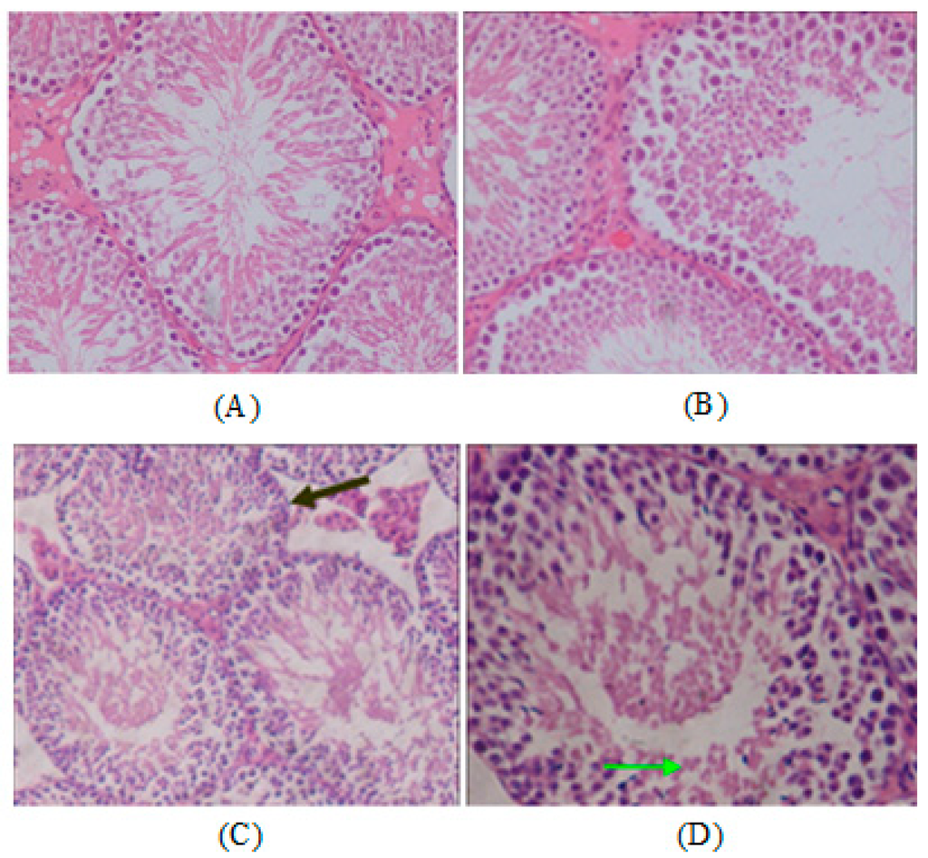 IJMS Free FullText Nickel Nanoparticles Exposure and Reproductive