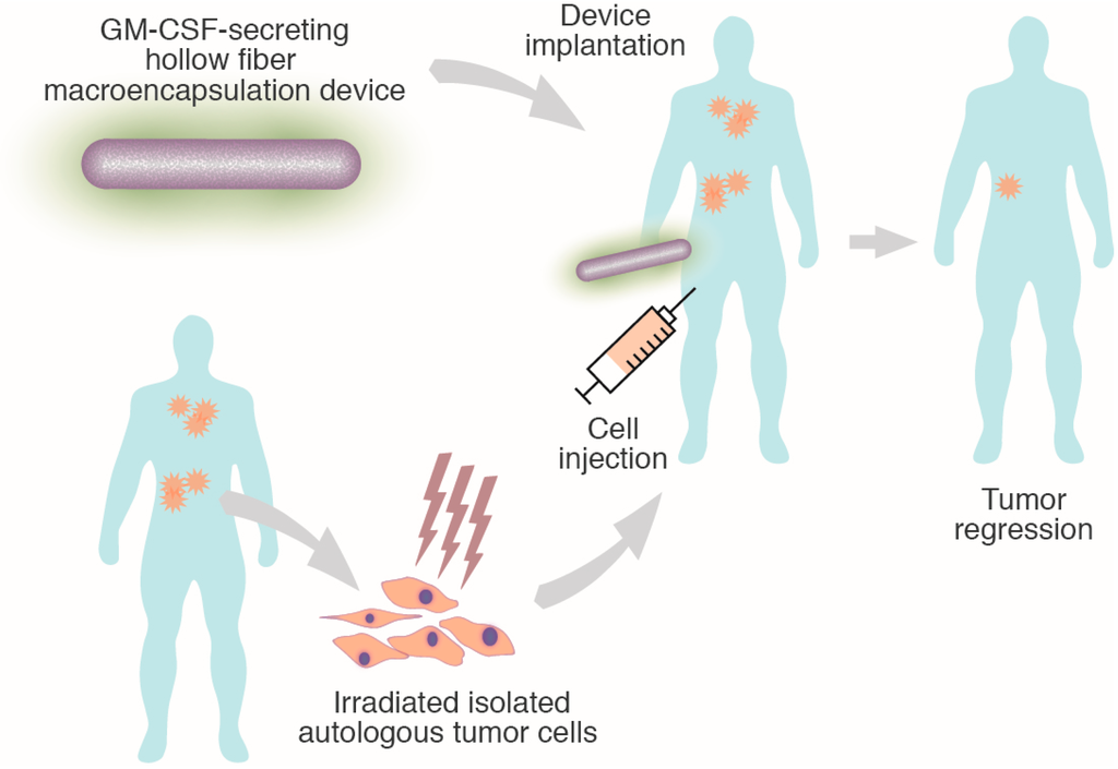 IJMS Free FullText Encapsulated Cellular Implants for