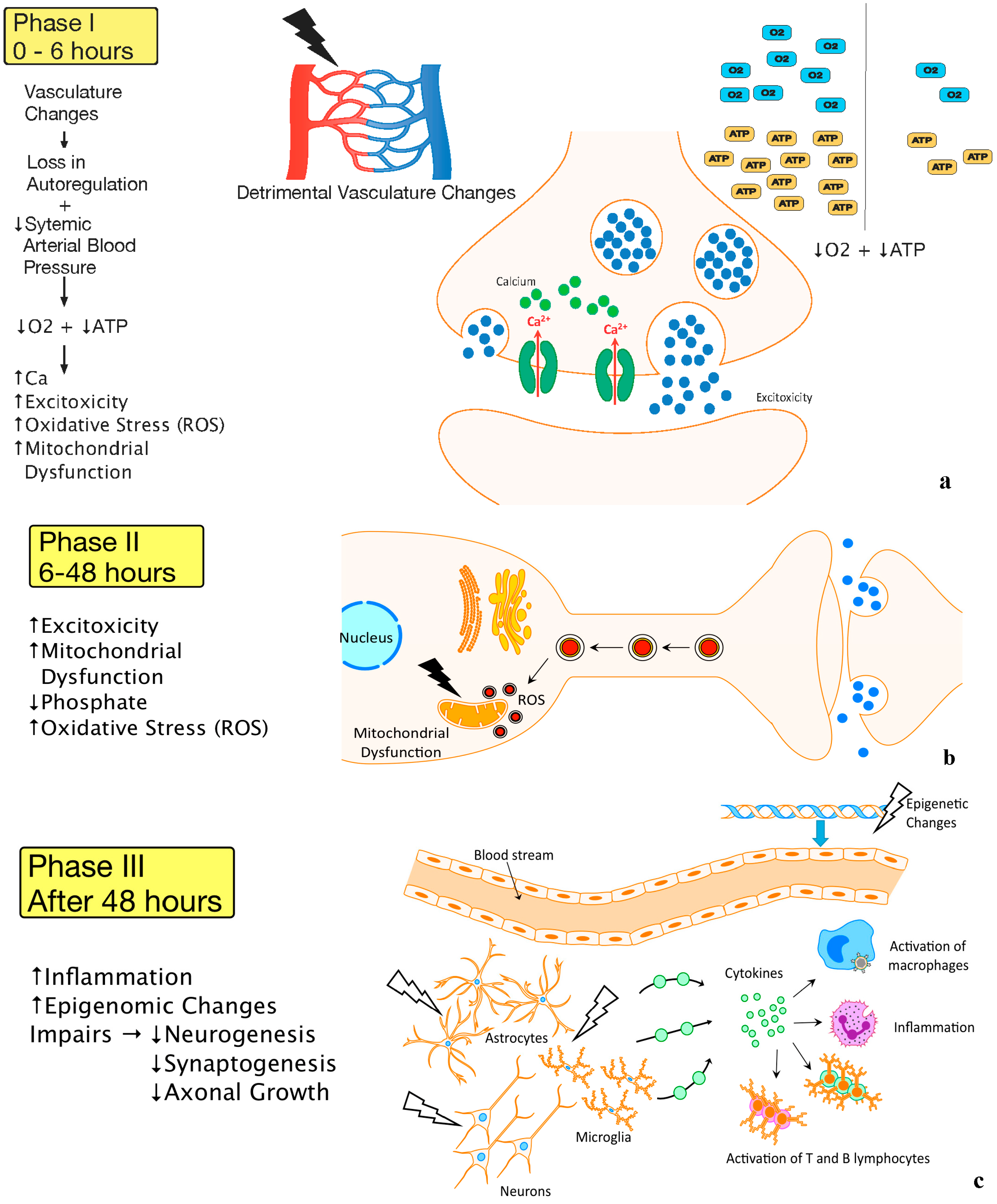 hypoxic ischemic encephalopathy