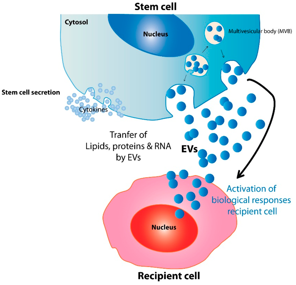 IJMS | Free Full-Text | Focus on Extracellular Vesicles: Therapeutic ...