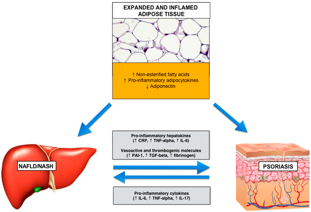 Alcoholic liver disease case presentation ppt image