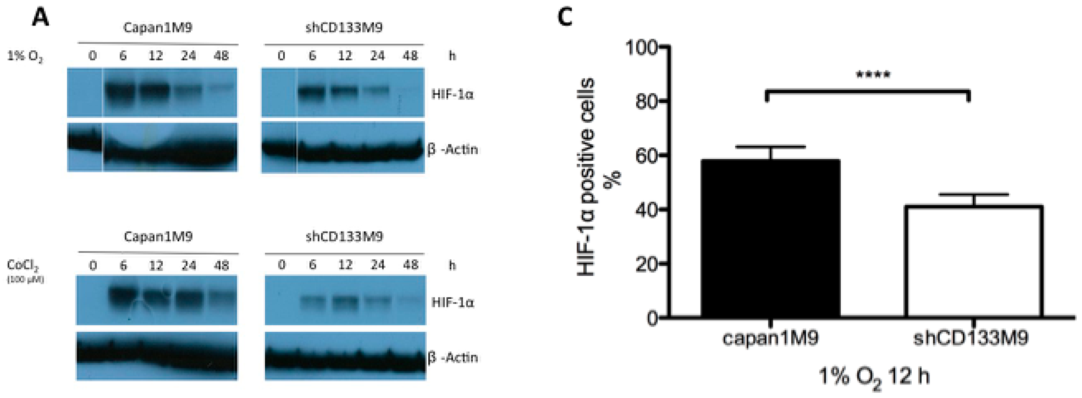 conditions of hypoxia in cells Anoxia is a condition characterized by an absence of oxygen supply to an organ or a tissue these research papers introduced a novel non-invasive technique to assess the blood cells age with special reference to hypoxic (low oxygen. conditions of hypoxia in cells Anoxia is a condition characterized by an absence of oxygen supply to an organ or a tissue these research papers introduced a novel non-invasive technique to assess the blood cells age with special reference to hypoxic (low oxygen.