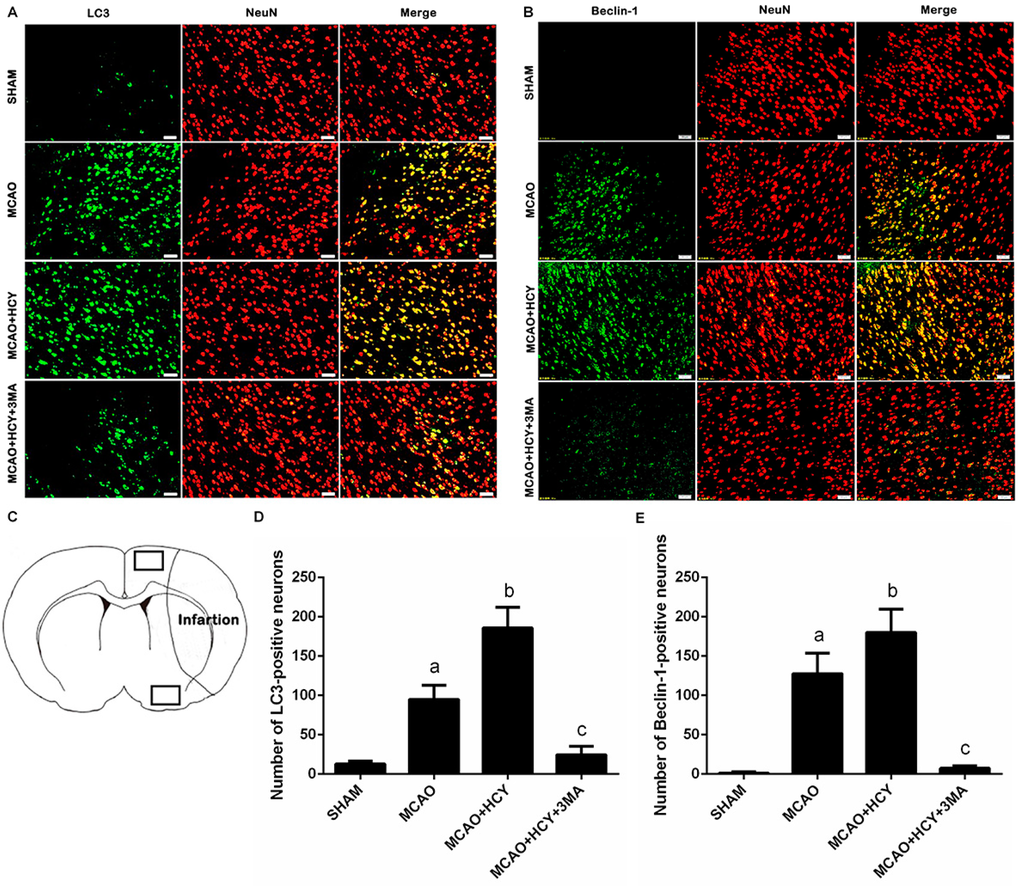 IJMS | Free Full-Text | Homocysteine Aggravates Cortical Neural Cell