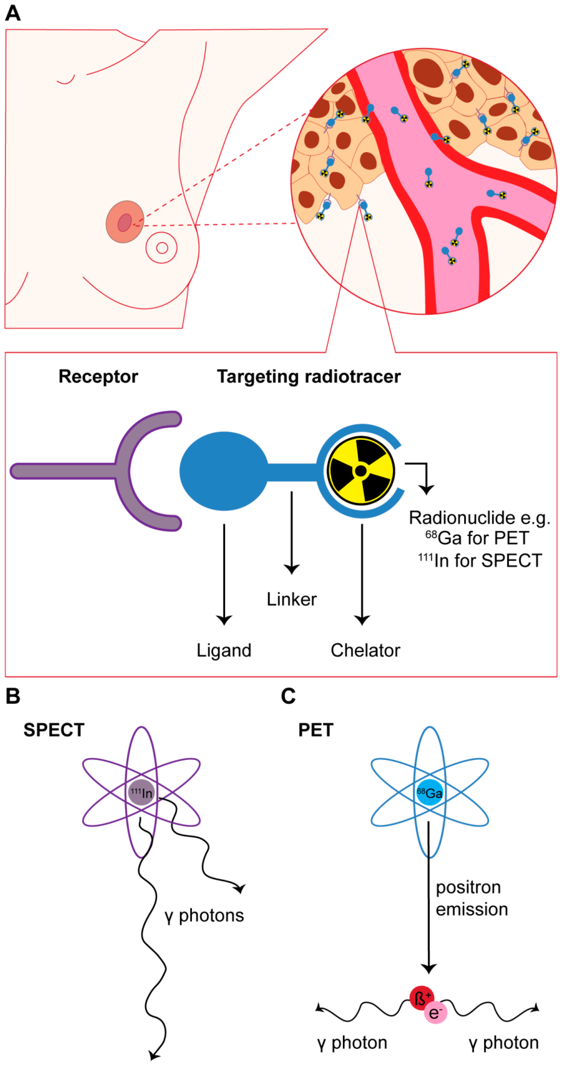 Infrared thermography for breast cancer detection