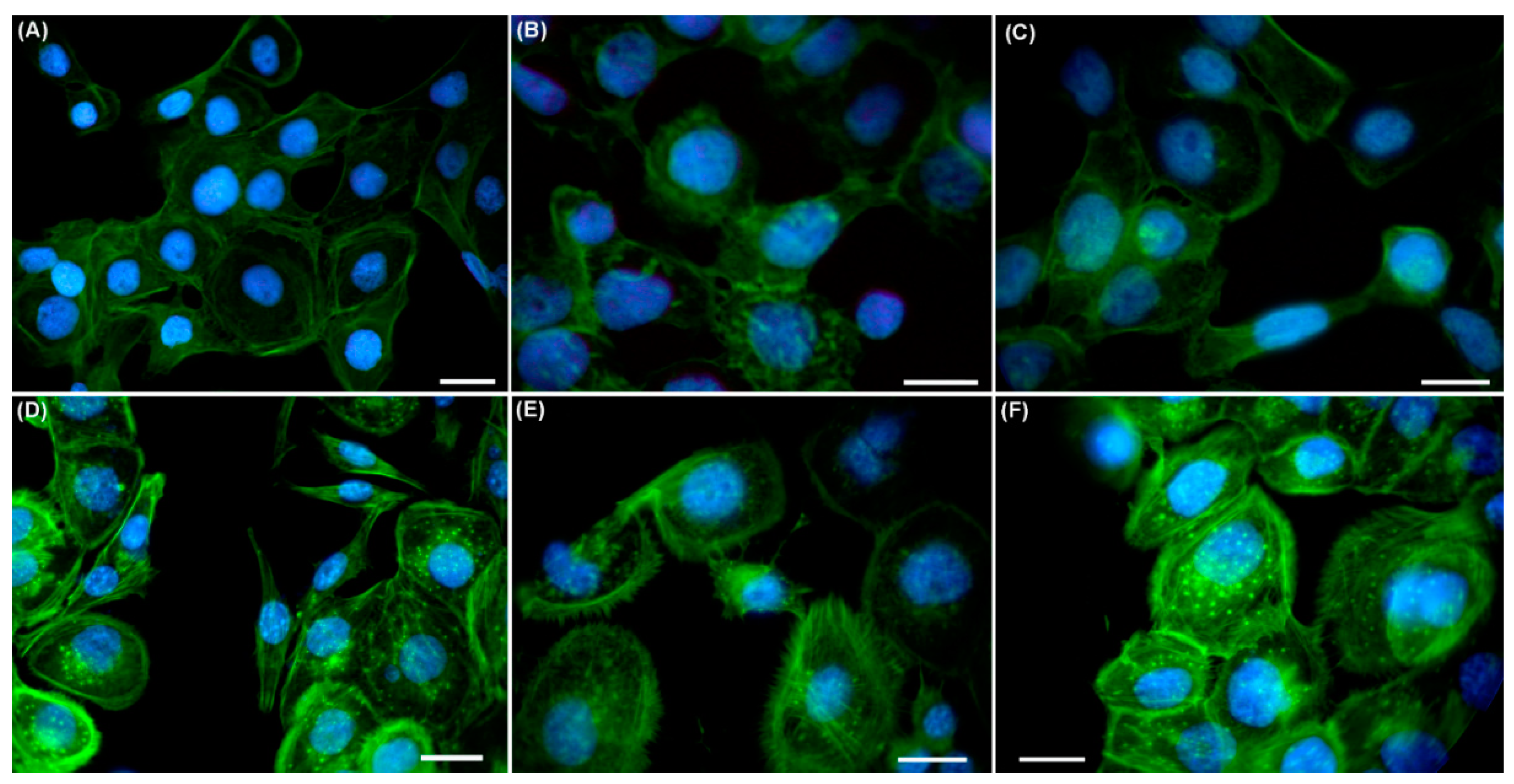 Ijms 19 01700 g006