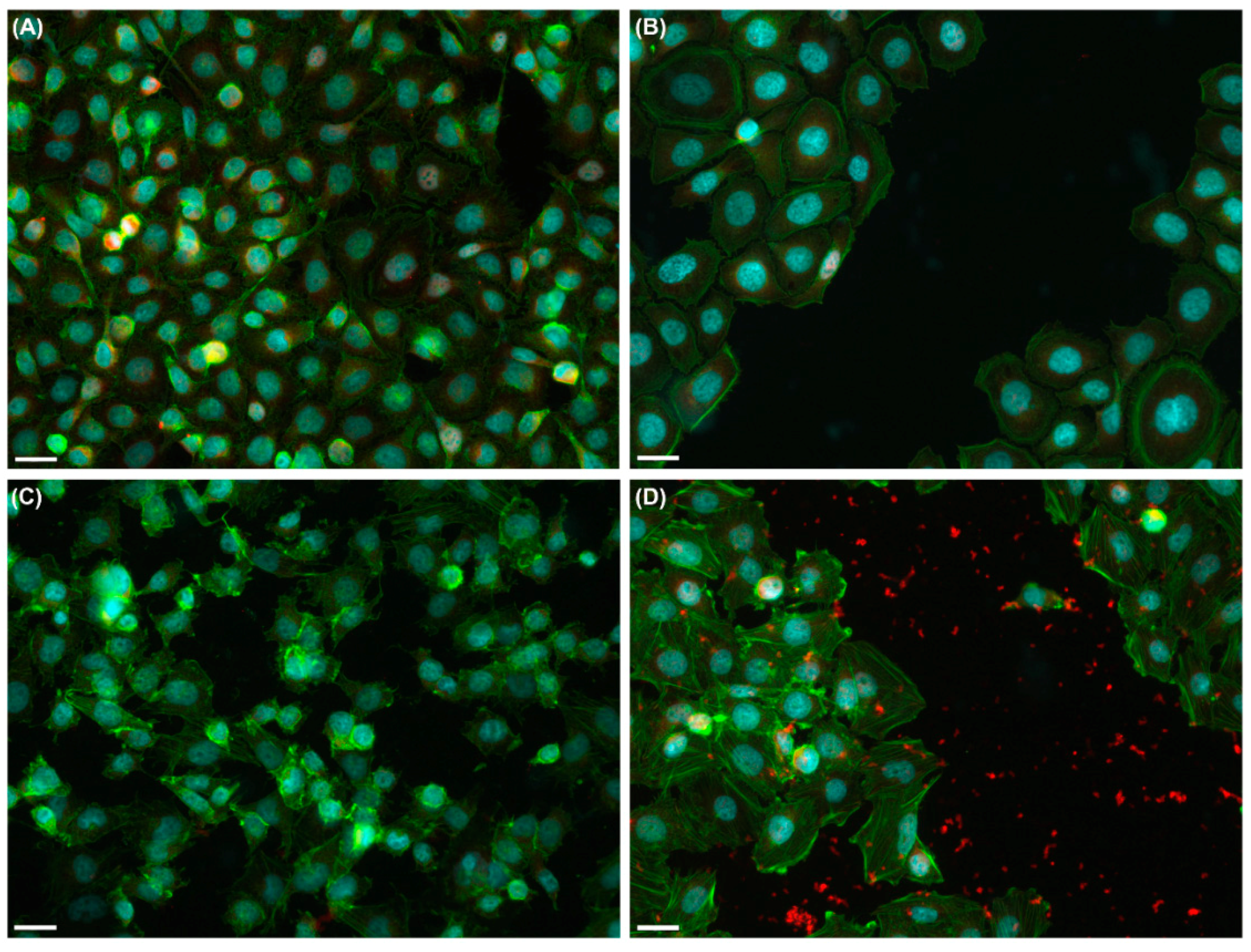 Ijms 19 01700 g007