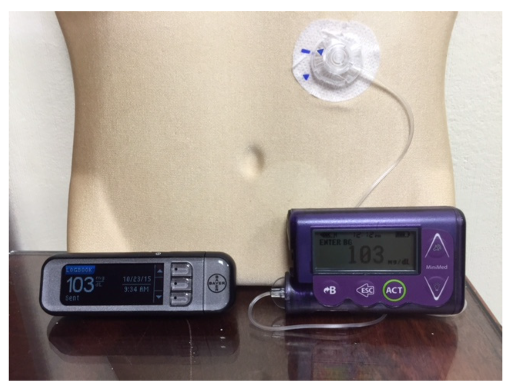 Free Blood Glucose Meter >> JCM | Free Full-Text | An Overview of Insulin Pumps and ... Free Blood Glucose Meter >> JCM | Free Full-Text | An Overview of Insulin Pumps and ...