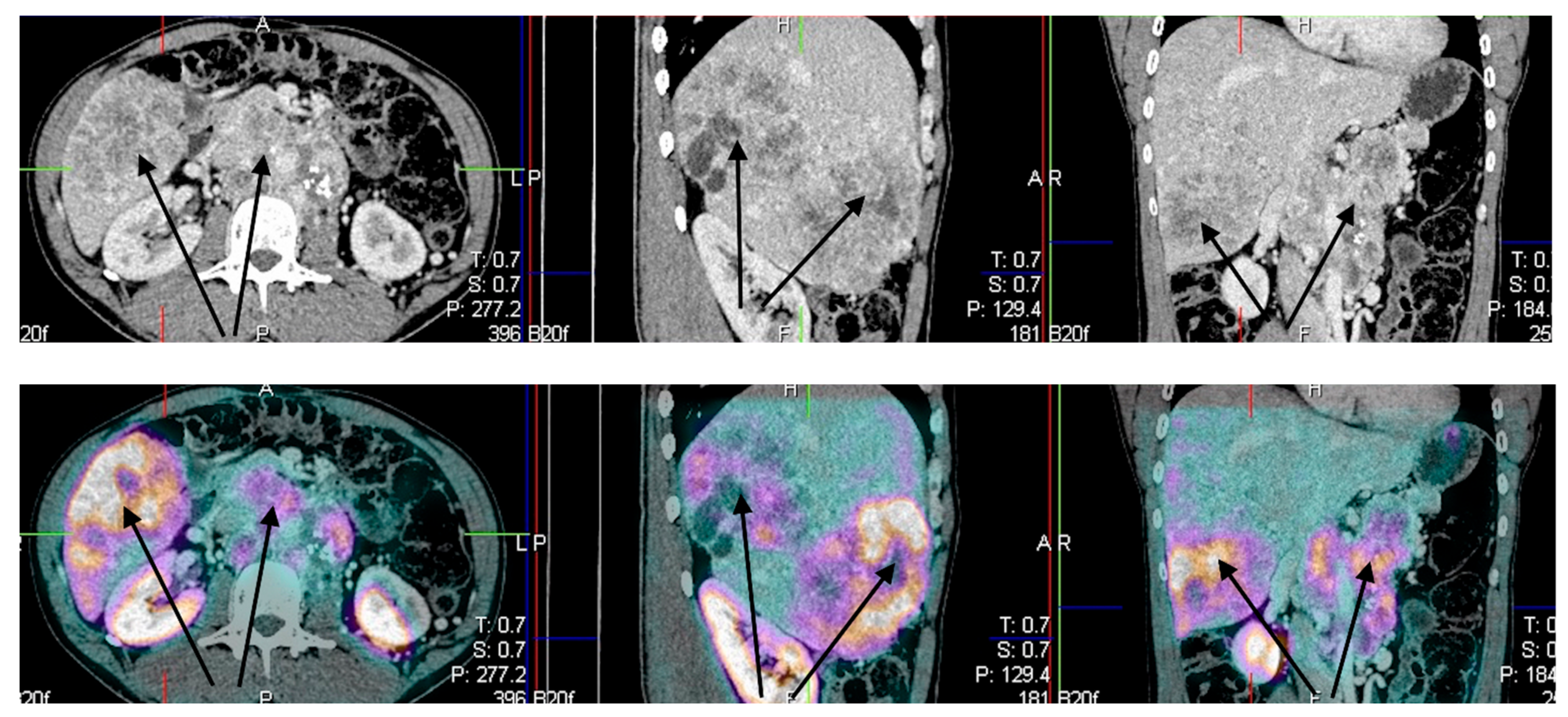 Jcm 08 00952 g006 Jcm 08 00952 g006