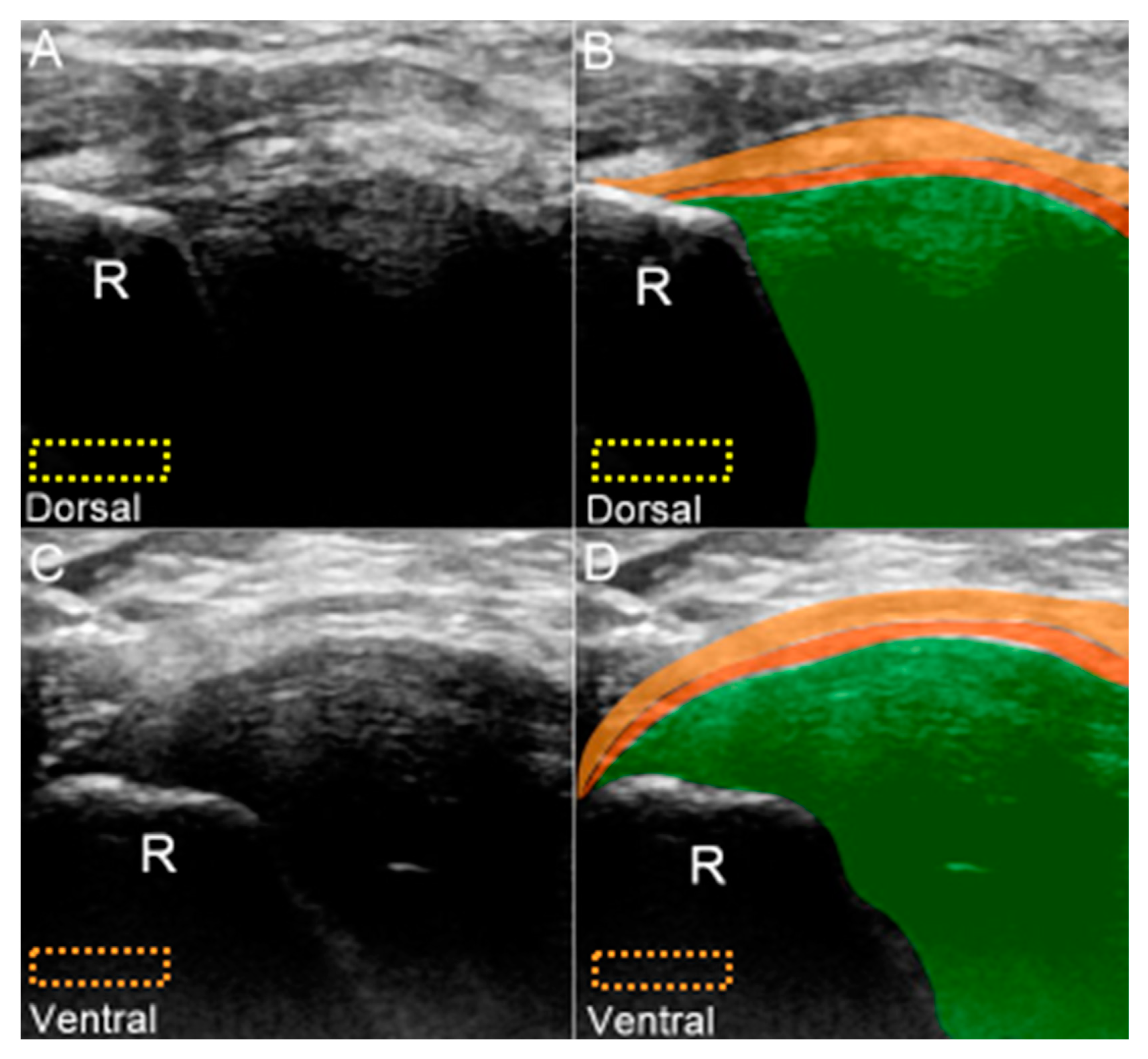 Jcm 08 01540 g007 Jcm 08 01540 g007