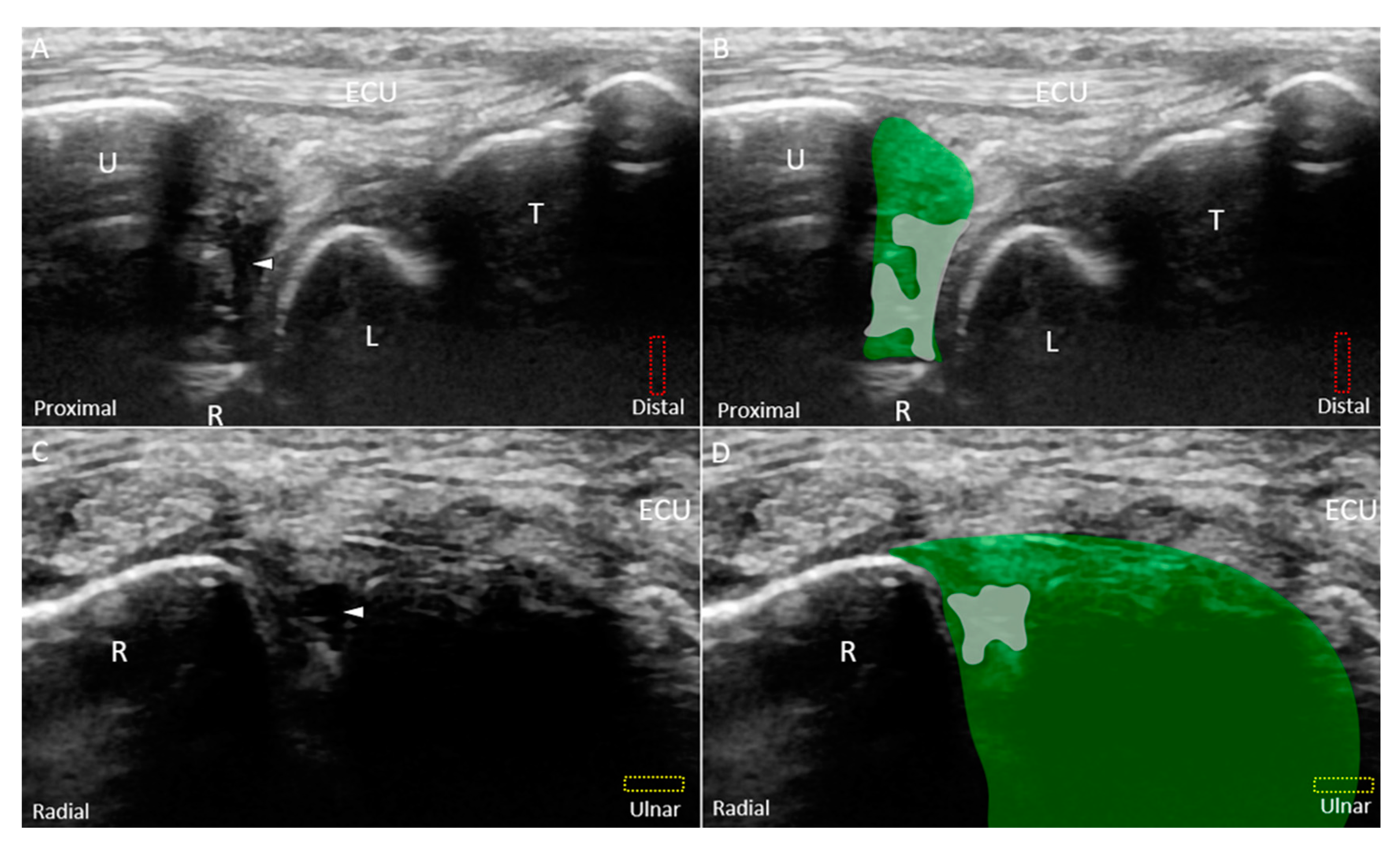 Jcm 08 01540 g010 Jcm 08 01540 g010