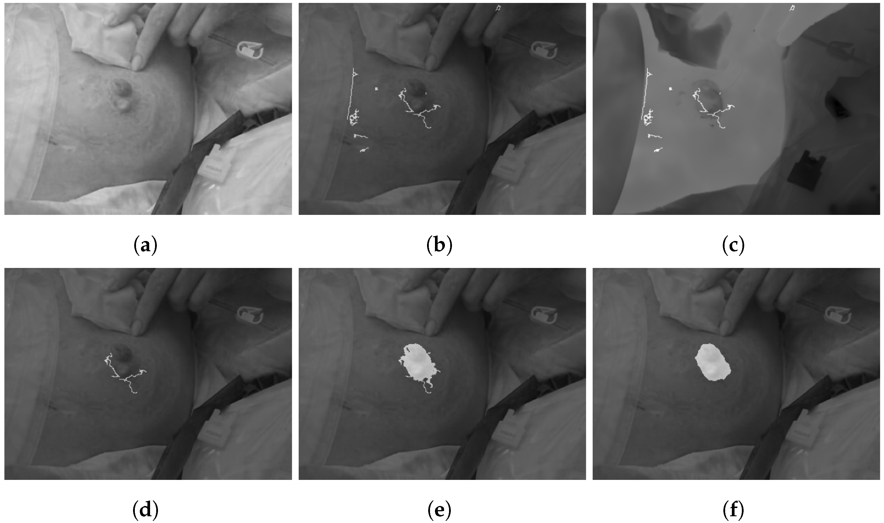 Jcm 11 00169 g002 Jcm 11 00169 g002