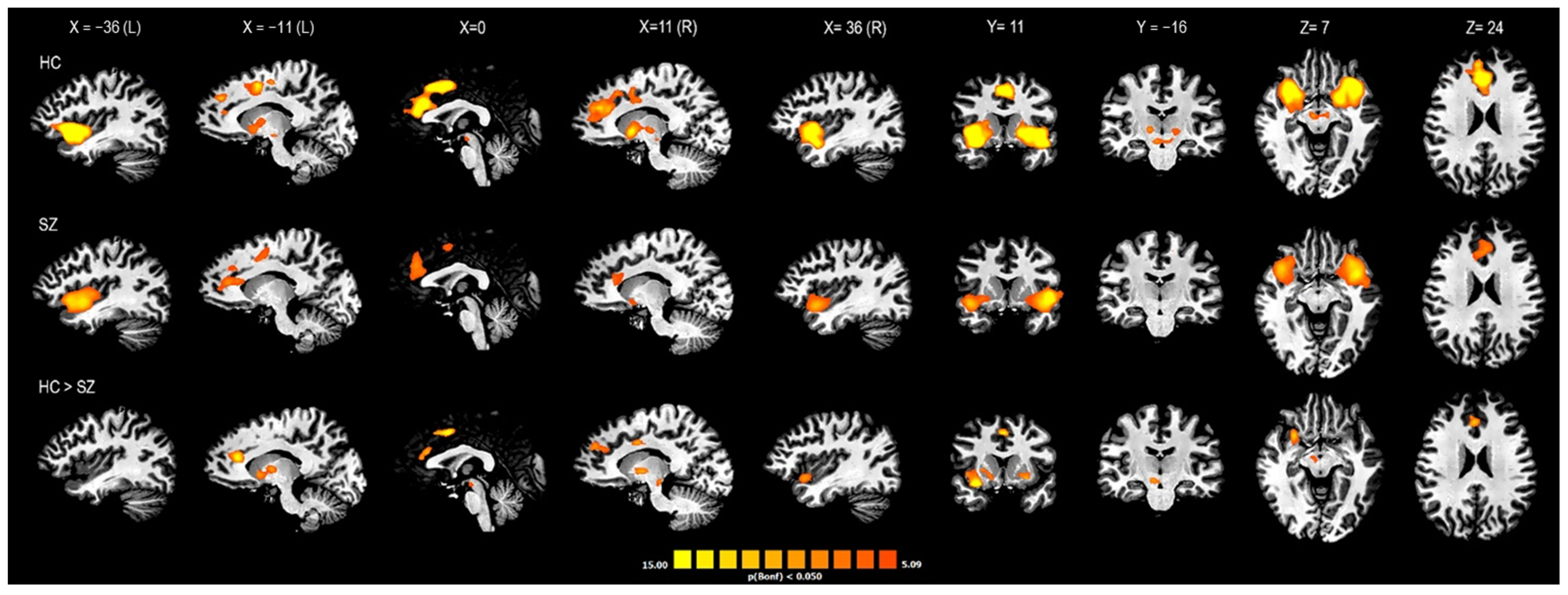 Jcm 12 01377 g004 Jcm 12 01377 g004
